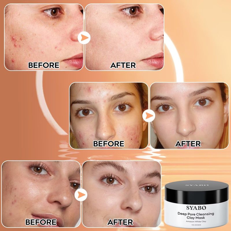 SYABO Amazonian White Clay Refreshing Pore Mask, Blackhead Remover for Face, Resurfacing Mask 200ml (7.05 Fl Oz)