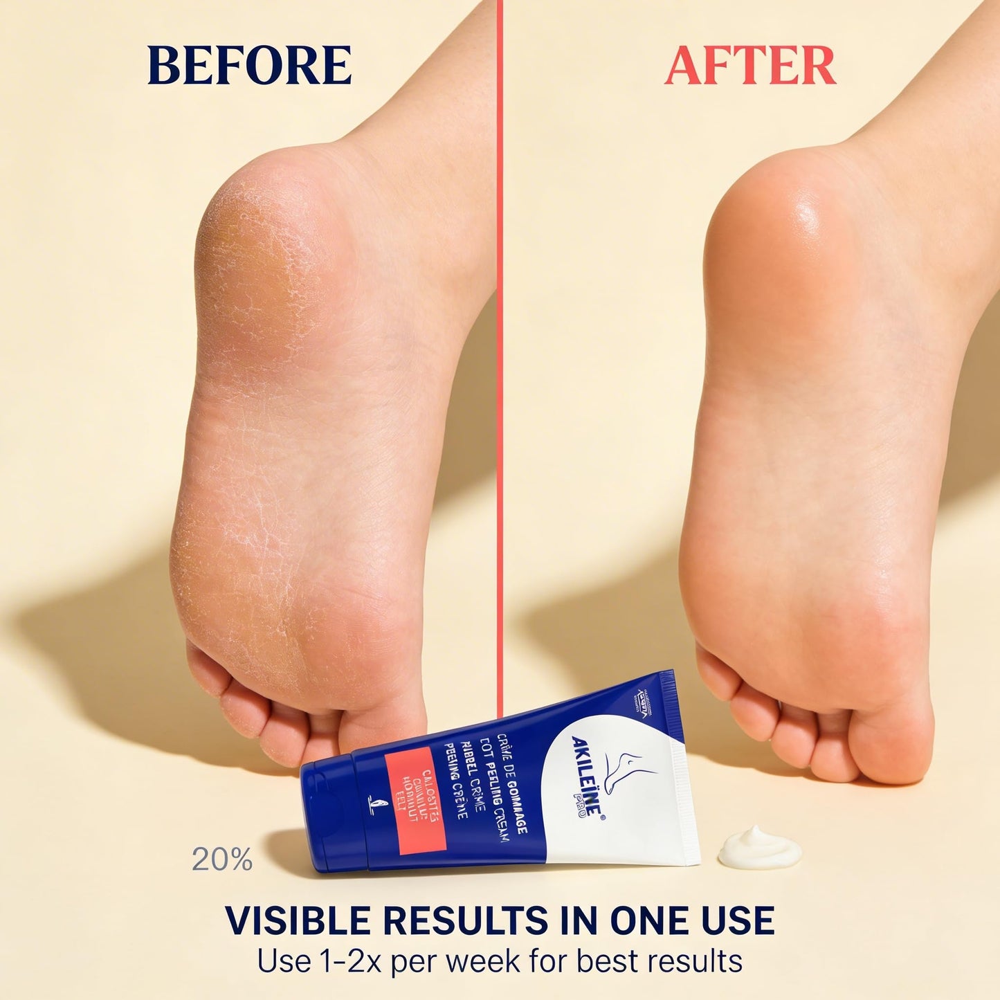 Foot Peeling Gommage Cream for Dry Feet with Calluses (150ml)