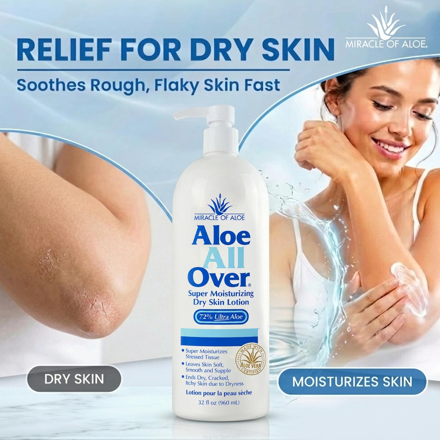 Miracle of Aloe Aloe All Over Super Moisturizing Dry Skin Lotion 32 oz - Made with 72% UltraAloe Aloe Vera Gel. Safe for Everyone: Men, Women, Kids. Restores Dry Skin Fast