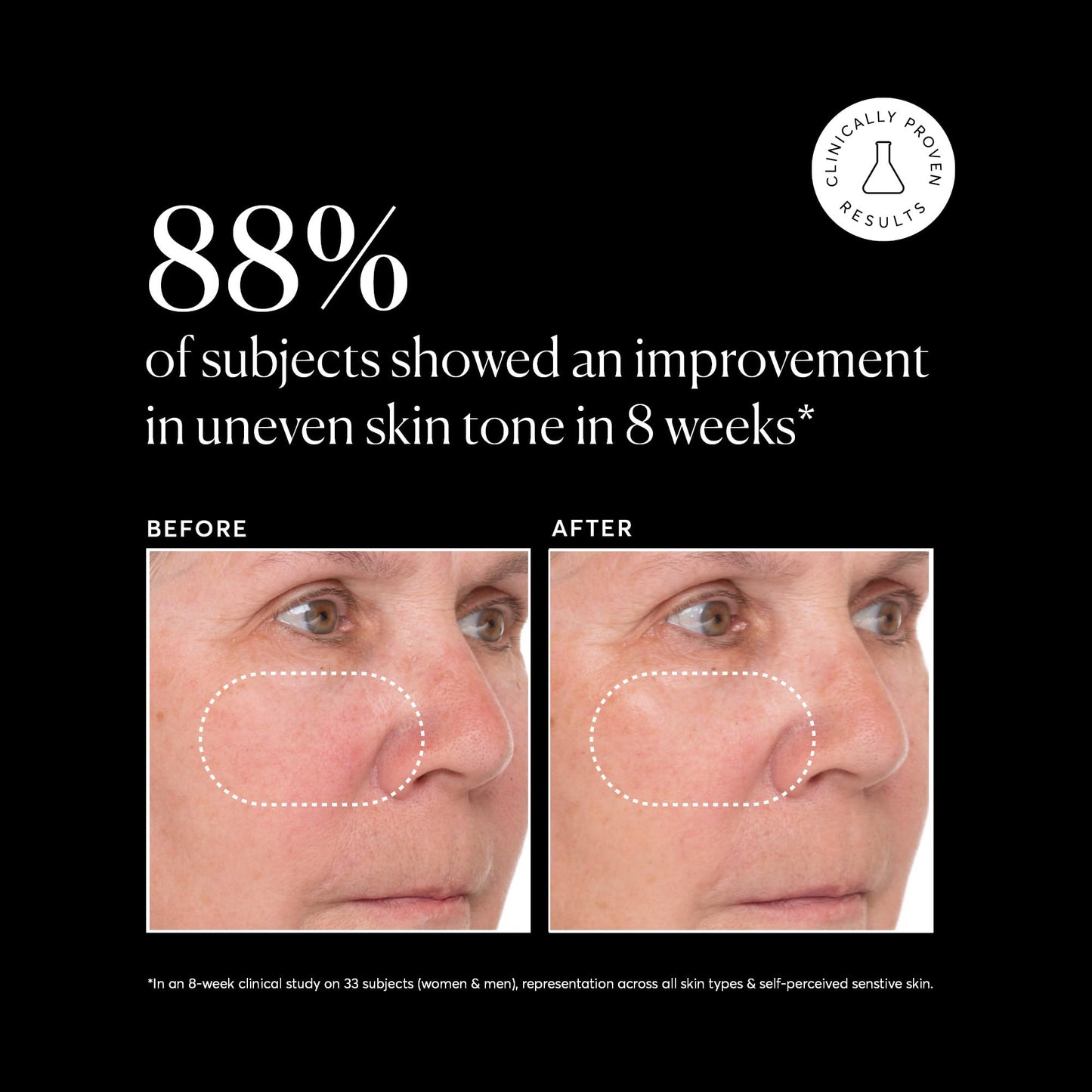 Naturium Vitamin C Super Serum Plus, Smoothing & Brightening Face Care, plus Retinol, Hyaluronic Acid, Niacinamide & Salicylic Acid