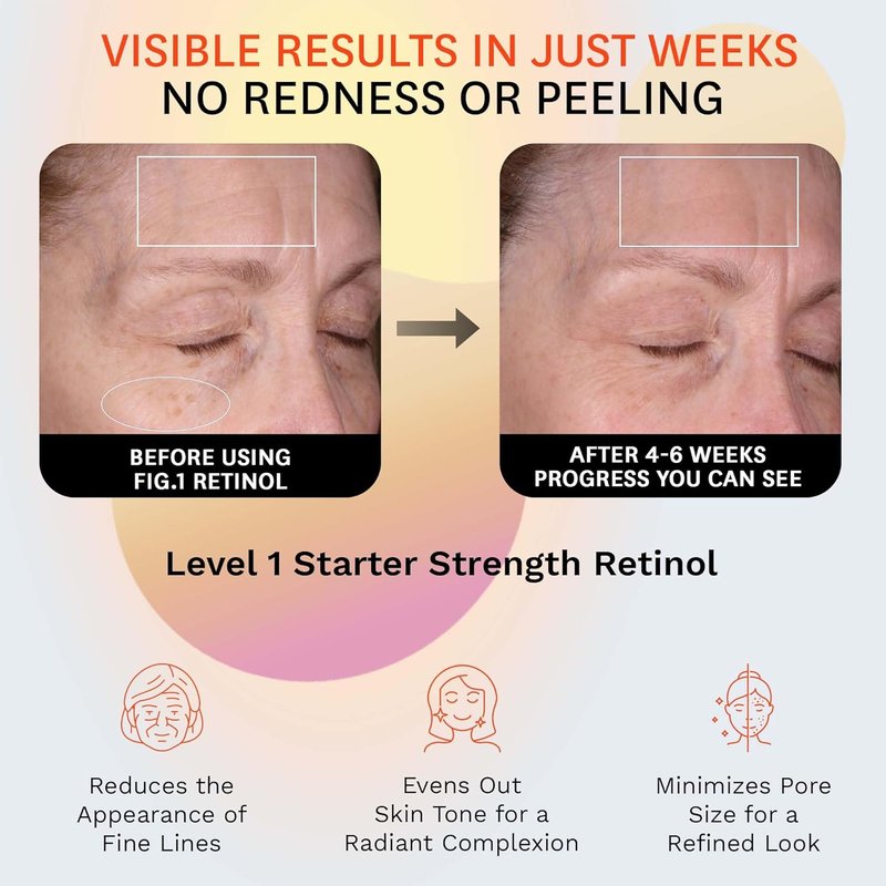Retinol Night Cream - Hydrating Face Moisturizer with Squalane for Sensitive Skin | Dermatologist Tested Wrinkle Reduction | 50ml / 1.7 fl oz
