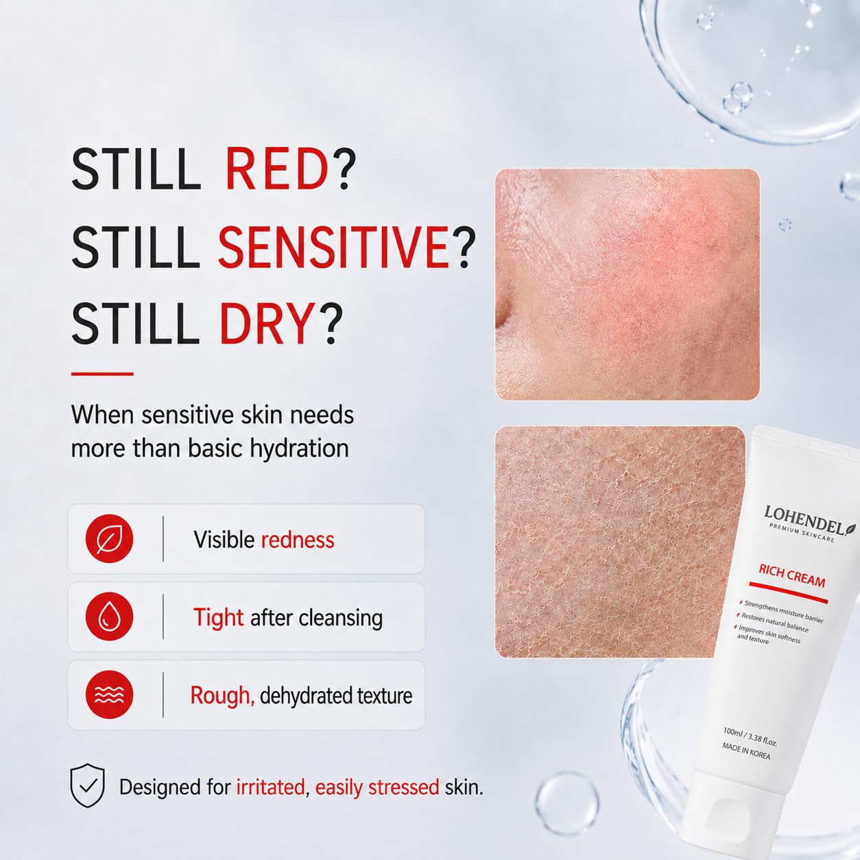 LOHENDEL Rich Cream - Soothe Irritated Skin, Intense Moisturizer