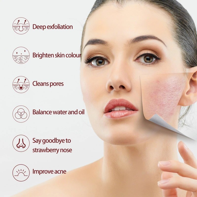 AHA 30% + BHA 2% Peeling Solution, Chemical Peel for Face at Home, BHA Liquid Exfoliant for Large Pores, Wrinkles & Fine Lines, 1.0 FlOz (1 PCS)