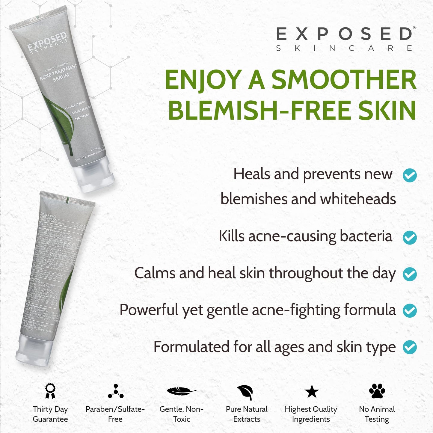 Exposed Skin Care, Acne Treatment Serum with 3.5% Benzoyl Peroxide – Lightweight Acne Spot Treatment – Quickly Clear Teen, Adult, Hormonal and Cystic Acne – Natural, Non-toxic and Cruelty Free