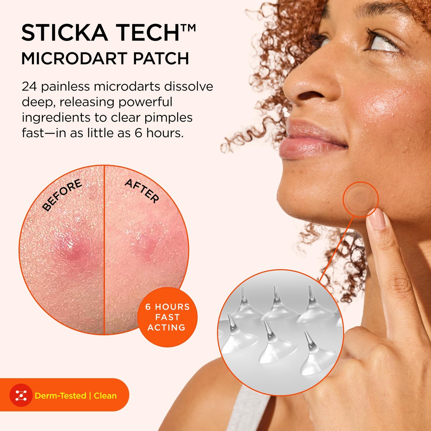 ZitSticka Killa Microdart Pimple Patches for Face - Most Potent Pimple Patch with Fast-Acting Microdarts - For Deep, Early-Stage Zits with Salicylic Acid - Mini 24 Count