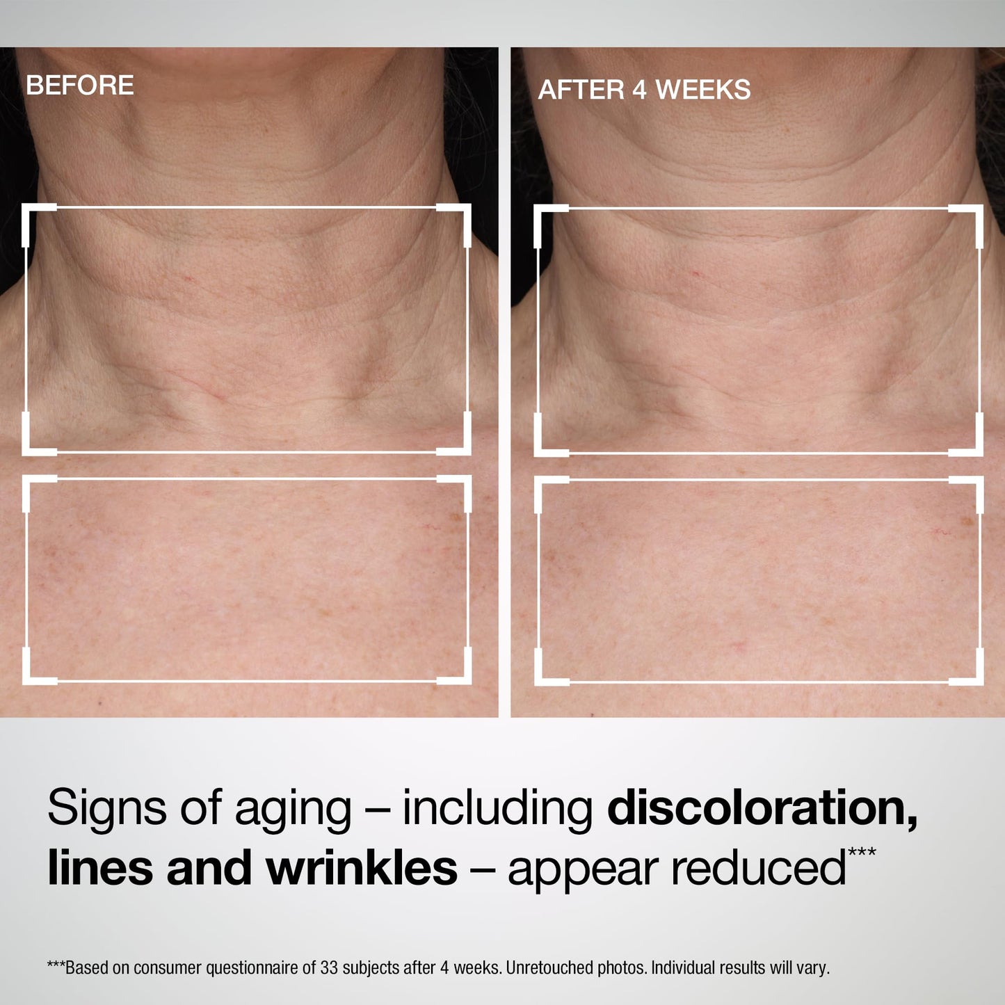 StriVectin TL Advanced Tightening Neck & Chest Lotion Broad Spectrum SPF 35 Sunscreen