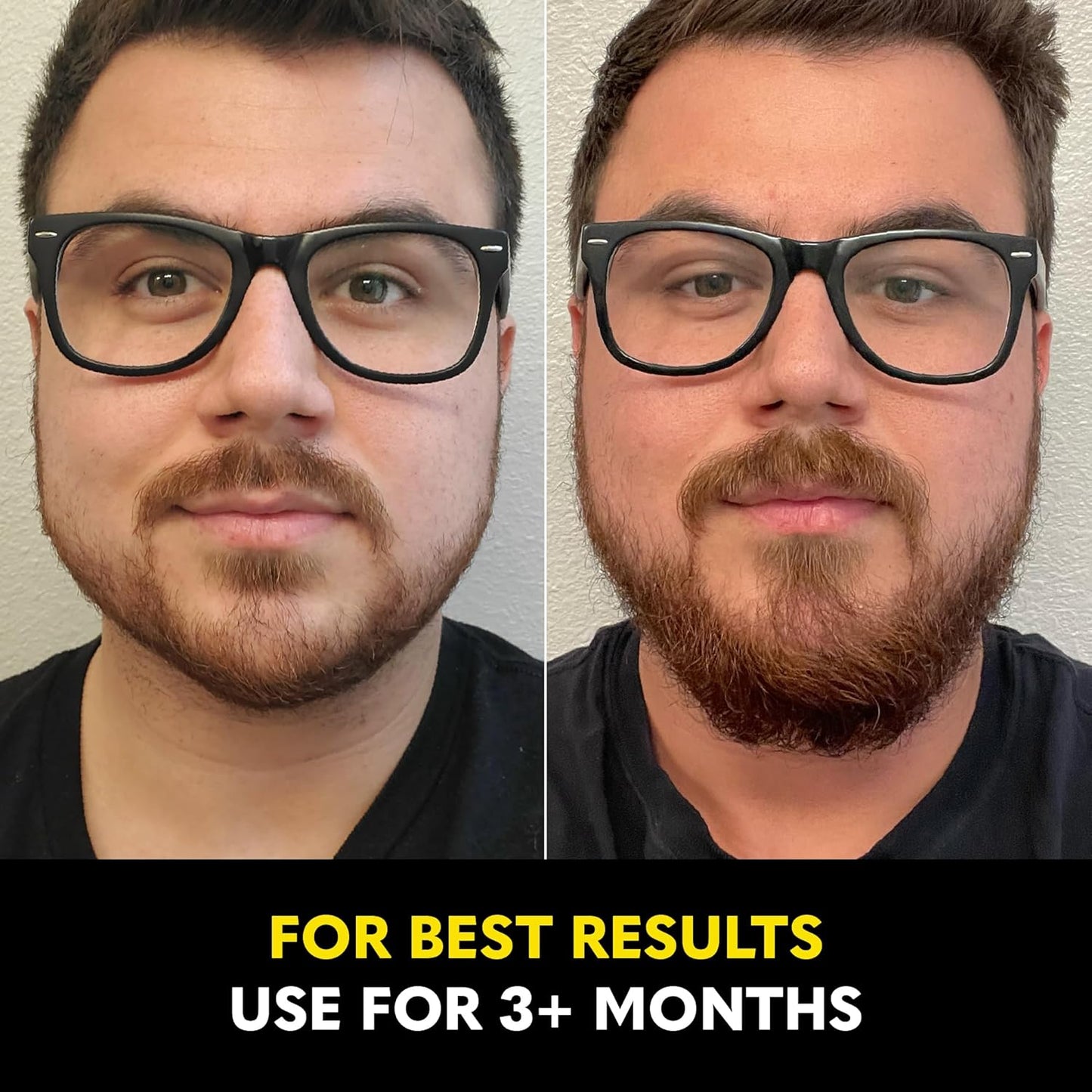 Beard Growth Serum - Natural Castor, Coconut & Avocado Oil for Thicker, Fuller Beards | Stimulates Healthy Hair Growth