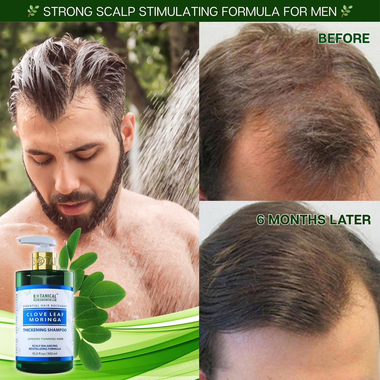 Botanical Hair Growth Shampoo for Hair Thickening Anti-Thinning Scalp Stimulating Natural Anti-Hair Loss Therapy For Women & Men 10.2 Fl Oz