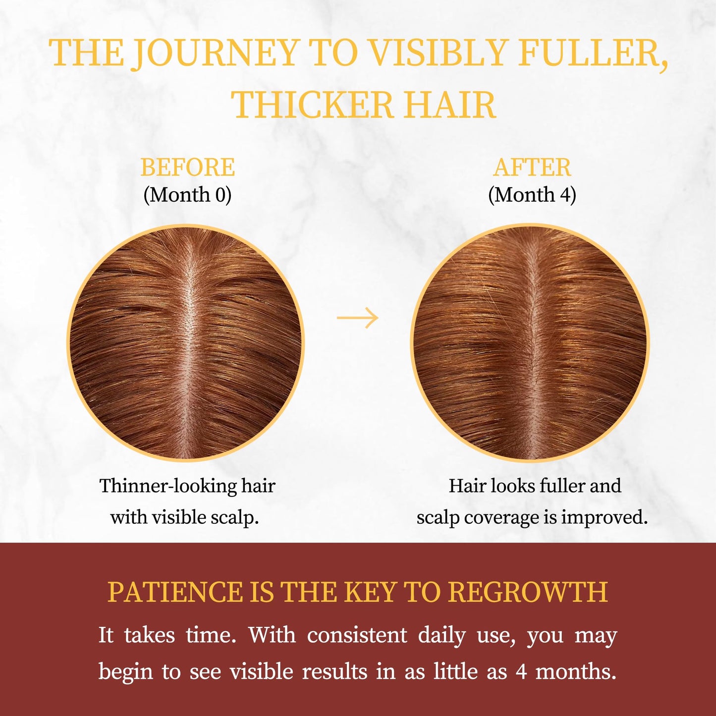 Minoxidil for Women Hair Growth with Biotin, Extra Strength Topical Minoxidil Serum Solution with Rosemary for Hair Regrowth Treatments, Non-Greasy, Helps Prevent Hair Thinning & Hair Loss