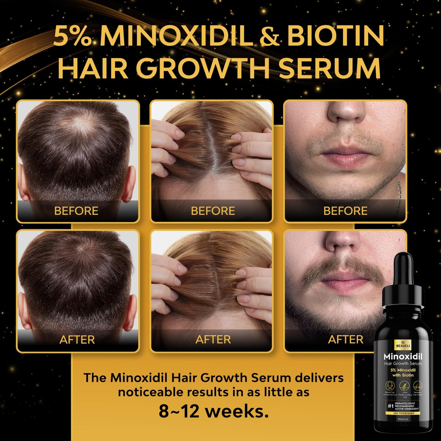 Beaueli 5% Minoxidil for Men and Women, Hair Growth, Beard Growth, Hair Regrowth, Unscented Drop, 3 Fl Oz, 3 Bottles