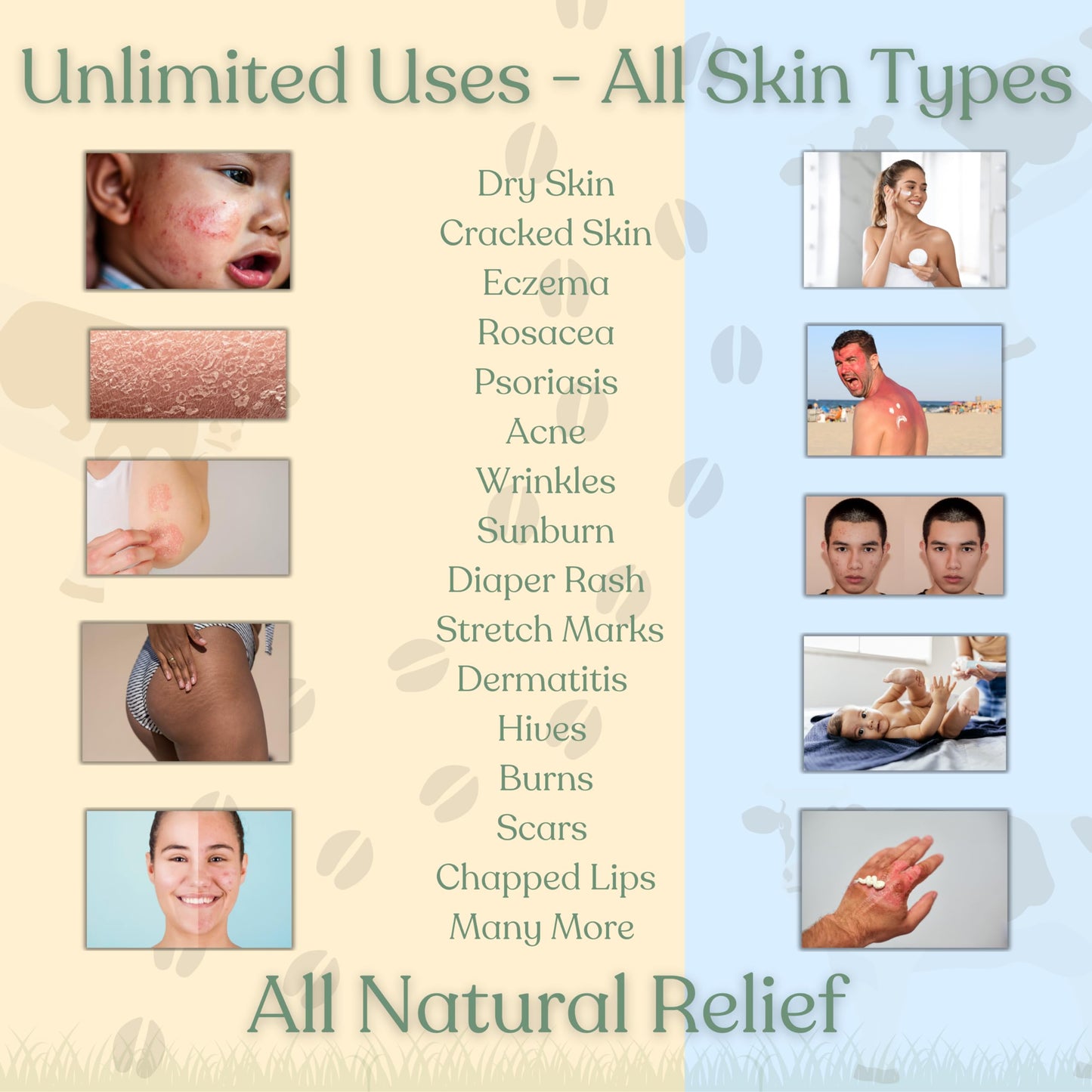 Beef Tallow for Skin - NAKED TALLOW BALM I 1 Ingredient - 100% Grass Fed Beef Tallow | Whole Body & Face | Whipped & UNSCENTED for Sensititve Dry Skin, Babies, Eczema, Psoriasis, Rosacea