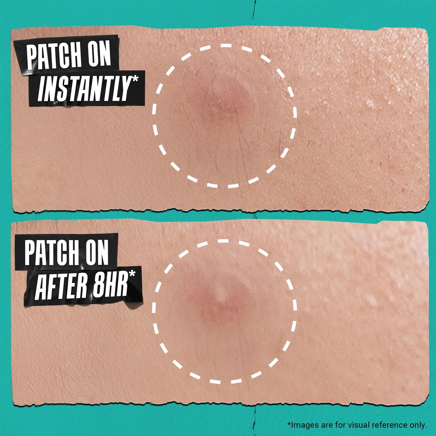 Kiehl's Overnight Pimple Patches - Truly Targeted Invisible Hydrocolloid Blemish Patch, Spot Stickers Absorb Oil and Gunk, Acne Treatment for Shrinking Whiteheads, Blackheads, and Zits (22 Count)