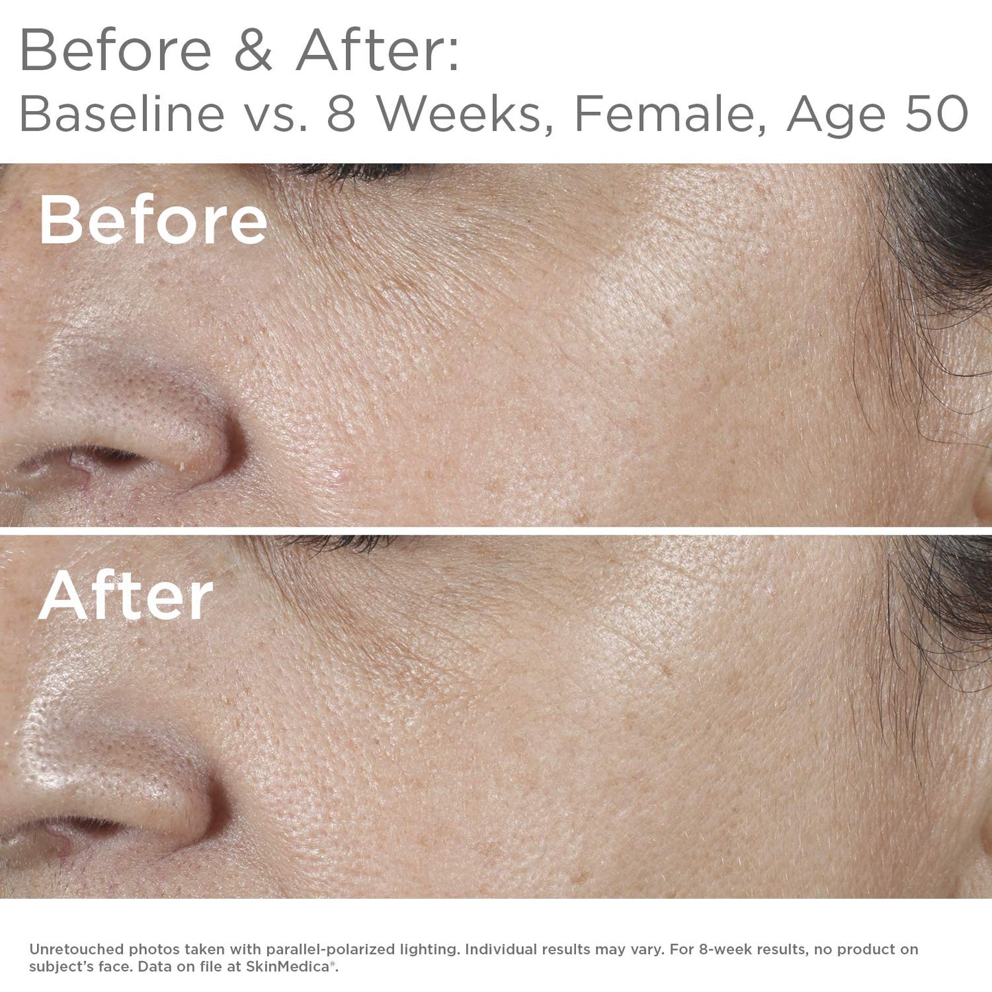 SkinMedica HA5 Rejuvenating Hydrator 1.0 oz.