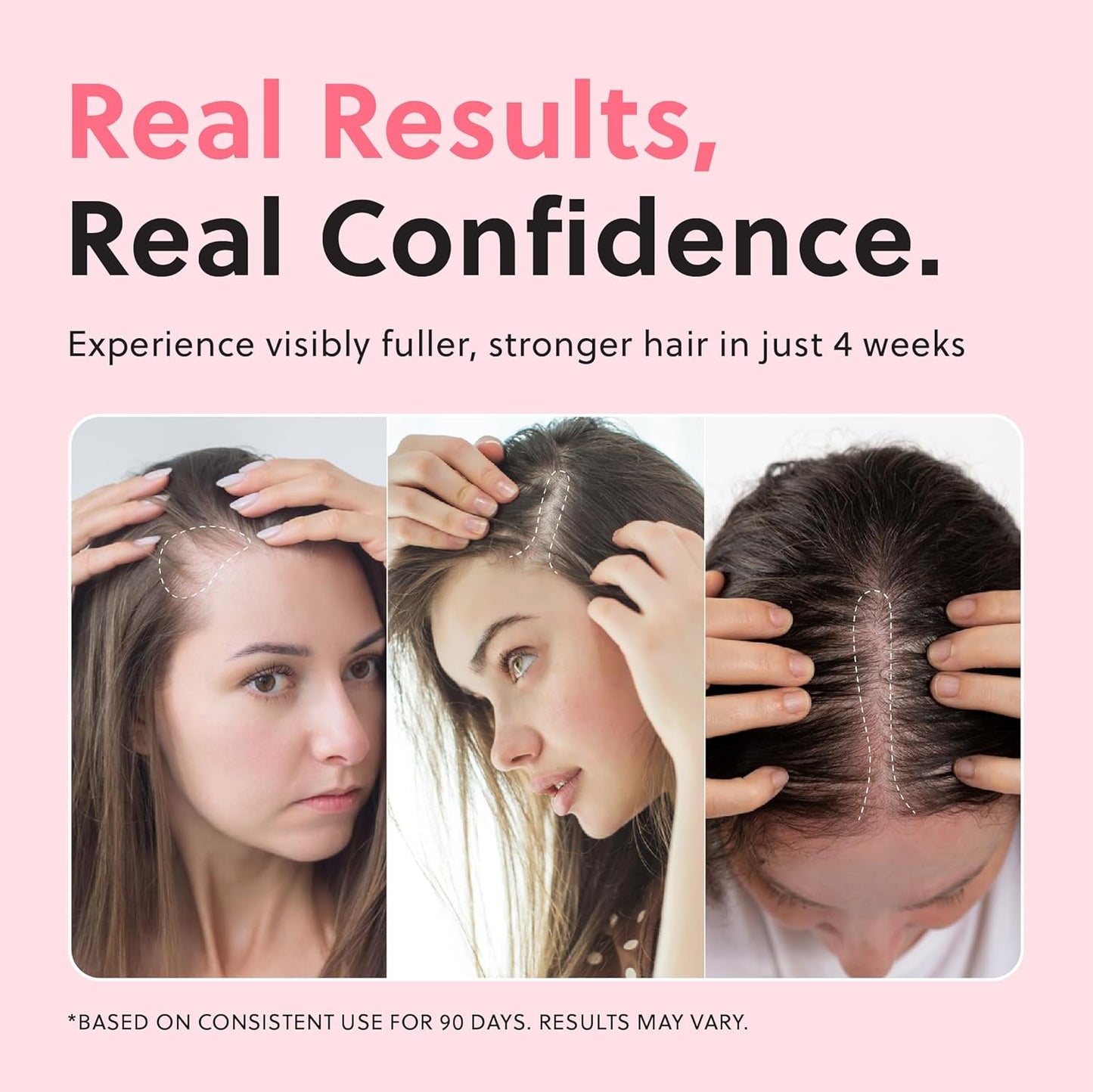 Hair Growth Serum for Women | Hormone-Free Regrowth Treatment for Thinning Hair - Fast Absorbing 50ml