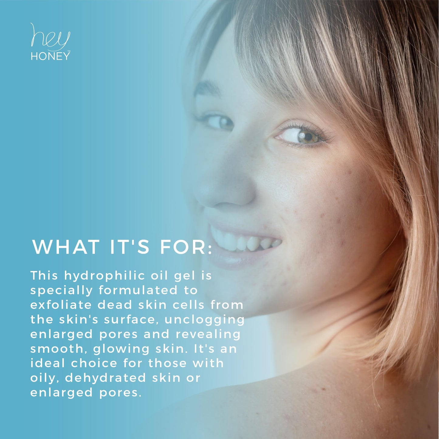 Hey Honey Skin Care Be Clear Acne Control Deep Pore Cleanser with Propolis, Tea Tree Oil & Green Tea | Pore Minimizer Face Wash for Oily Acne Prone Skin | 2.7 Oz