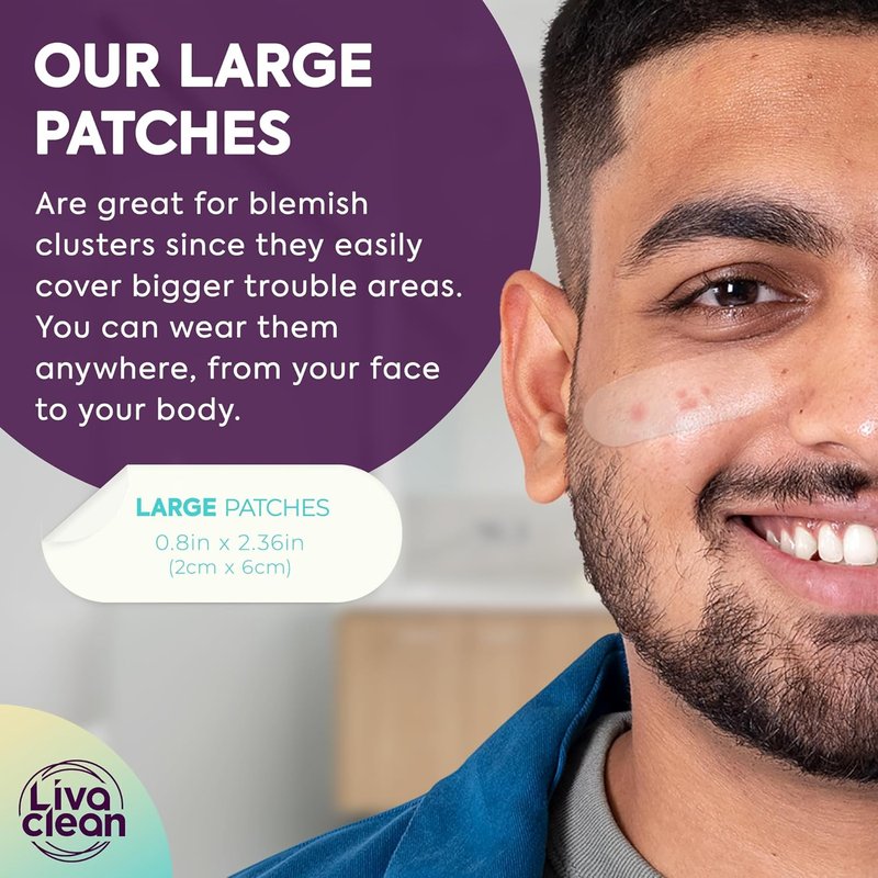 LivaClean Hydrocolloid Acne Patches | Large 100 CT for Cystic Pimples & Pore Spots