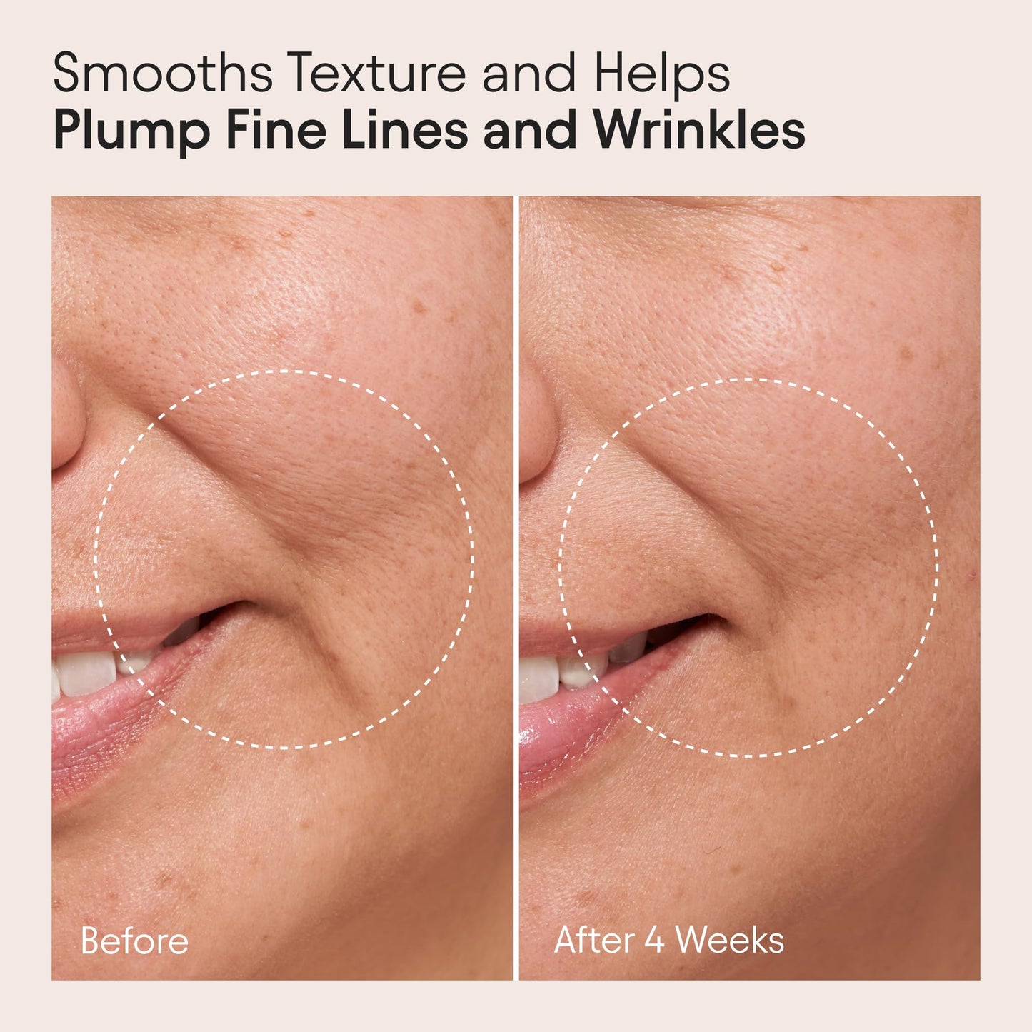 ALPYN Clarifying Facial Oil with Retinol & Pink Algae | Clear Congestion, Smooth Fine Lines, Improve Texture & Glow | 1 Fl Oz / 30 ml