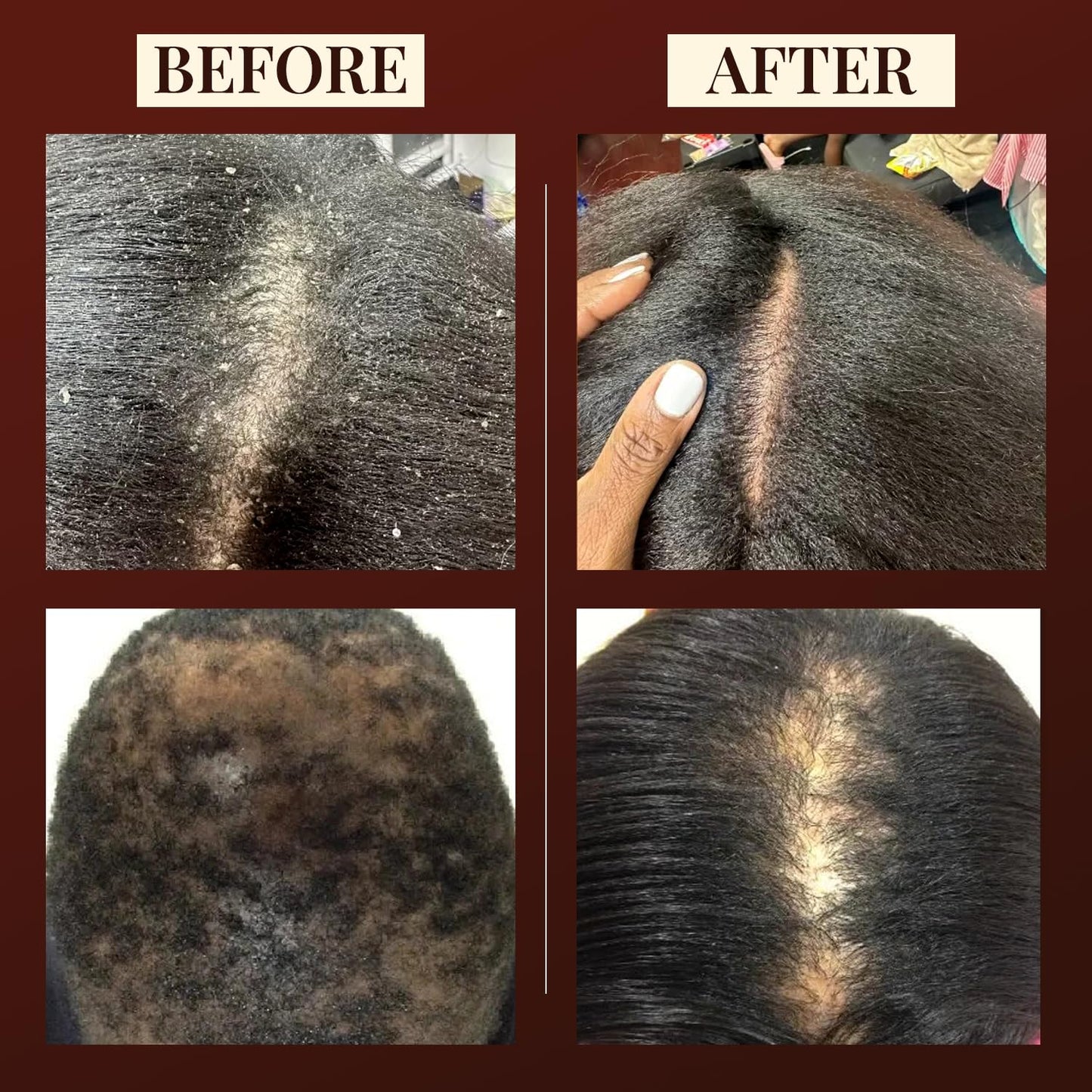 bahtana 100% Pure Batana Oil - Nourishing Hair & Skin Treatment for Growth, Strength & Moisture- Batana Oils for Soft, Shiny Hair & Glowing Skin- Oil for Daily Use- Restores Hairs & Skins Naturally