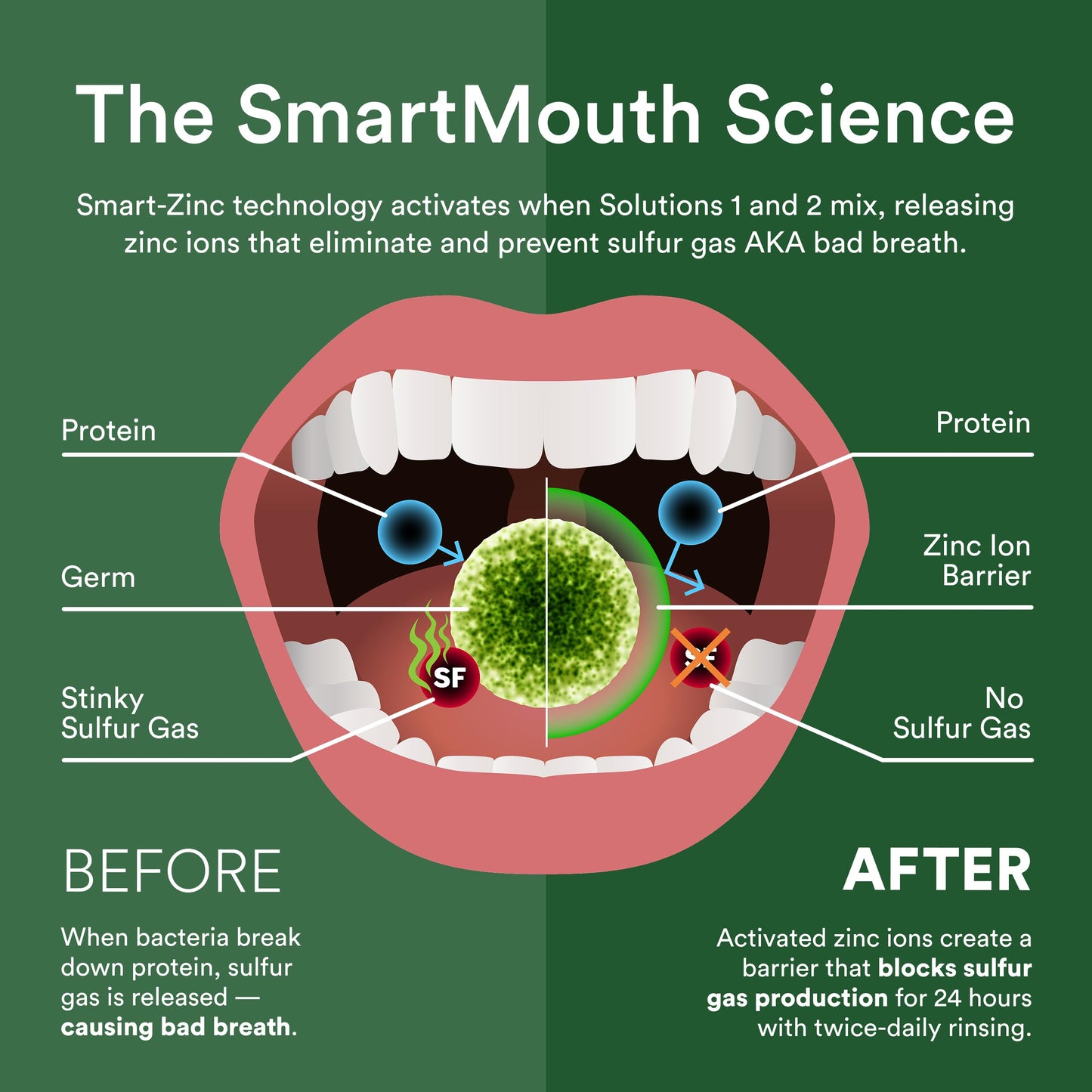 SmartMouth DDS Activated Clinical Mouthwash with Tongue Cleaner - for Fresh Breath - Clinical Strength Mouthwash for Gum Health, Gingivitis & More - Clean Mint Flavor, 16 fl oz (Pack of 2)