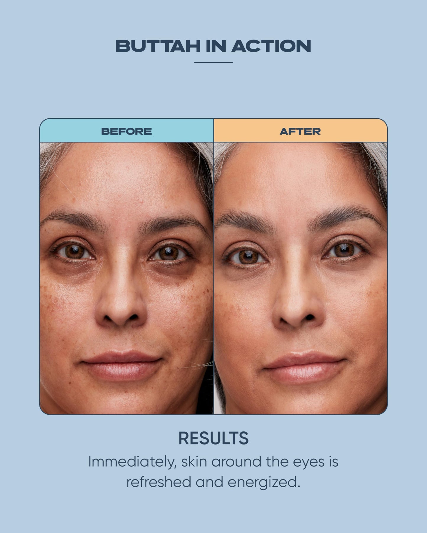 Buttah Skin Awakening Eye Cream for Dark Circles and Puffiness - Caffiene Pro Aging Eye Care Cream - Eye Cream For Wrinkles - Nourishing and Hydrating Under Eye Treatment