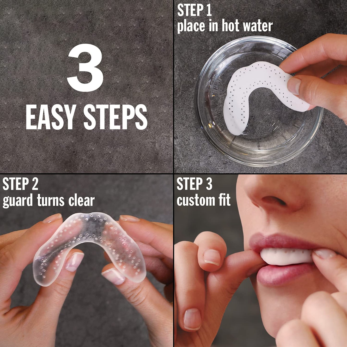 LunaGuard Nighttime Dental Protector – Comfortable Mouth Guard for Bruxism - Custom Fitted Protection for Teeth Grinding and Jaw Clenching Plus Storage Case