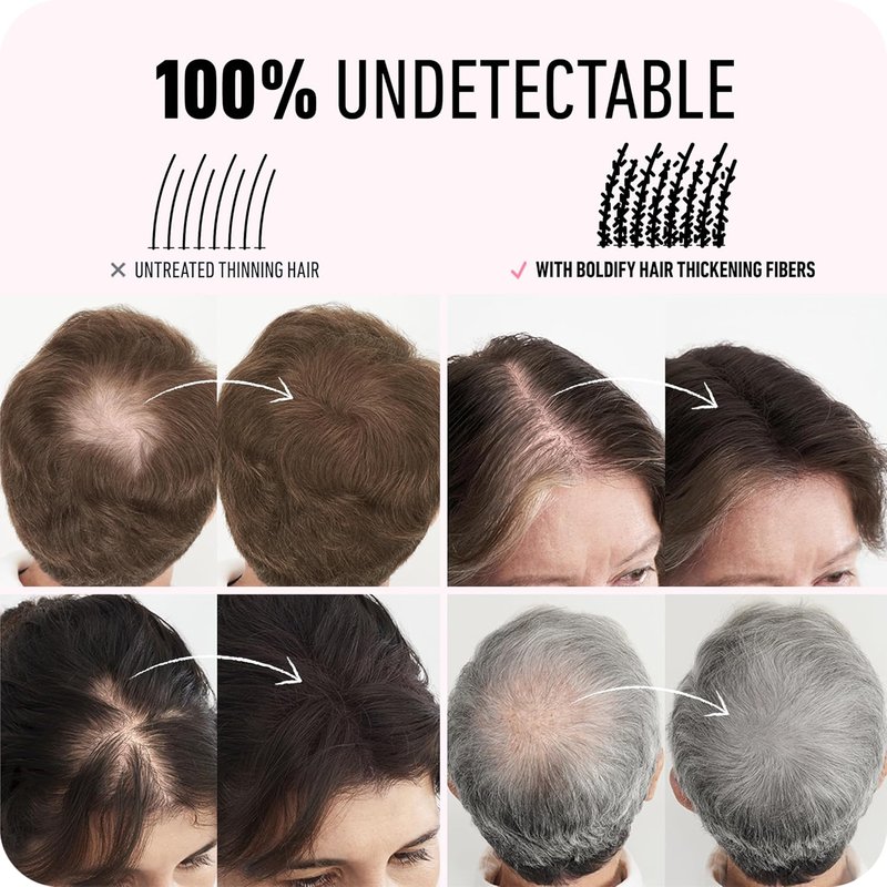 BOLDIFY Hair Fibers - Thinning & Fine Hair Solution for Instant Volume | Dark Brown, 2 x 56g, 14 Shades Available