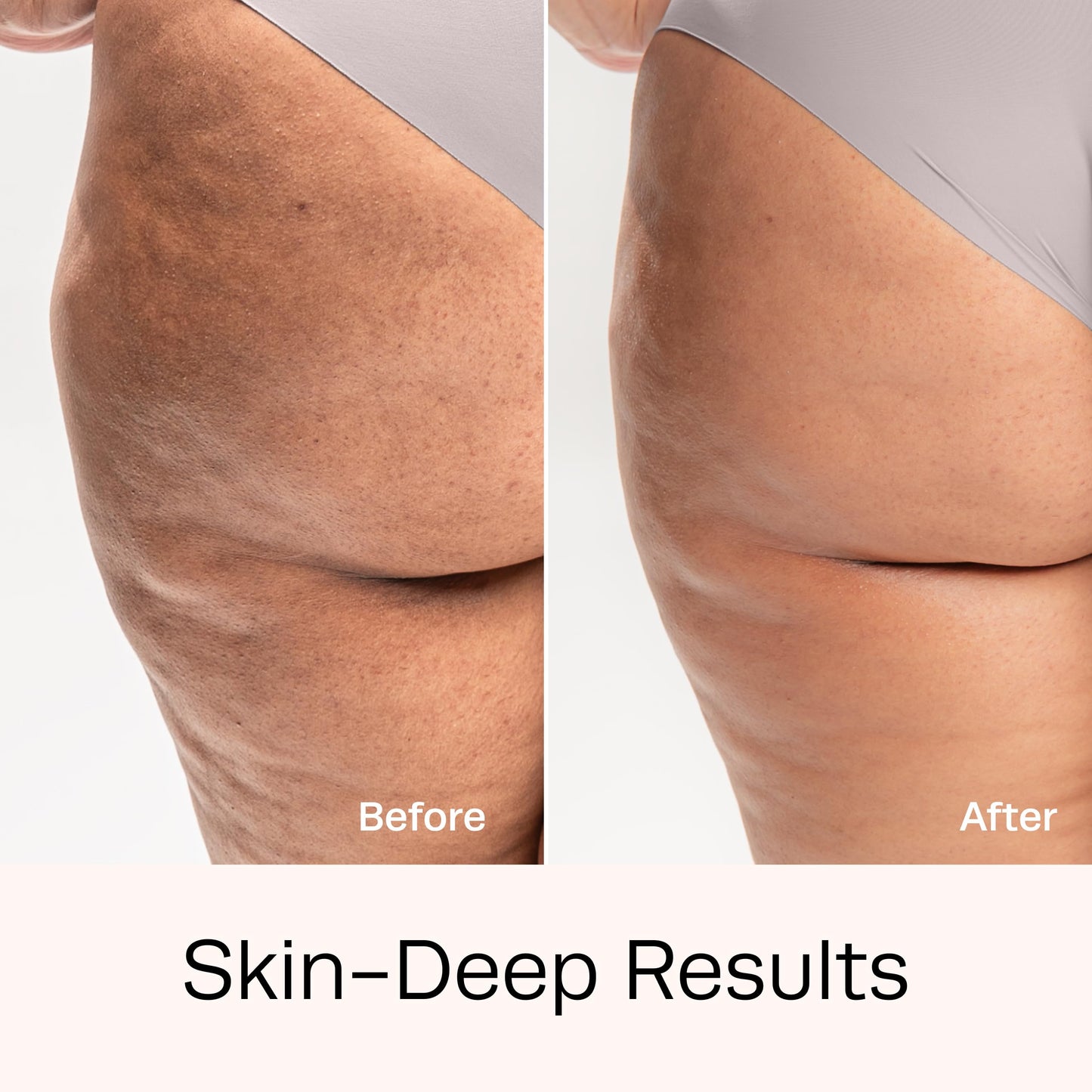 Hot Vita Retinol Toner – Roll-On Oil with Retinol for Smoother, Firmer-Looking Skin – Targeted Care for Belly, Thighs, Arms & Legs – Helps Improve Texture and Appearance