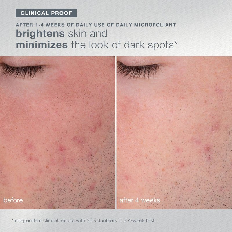 Dermalogica Your Moment of Expertise – Expert Level Skin Care Routine Set Includes 6 Products, Headband, Gua Sha, Fan Brush