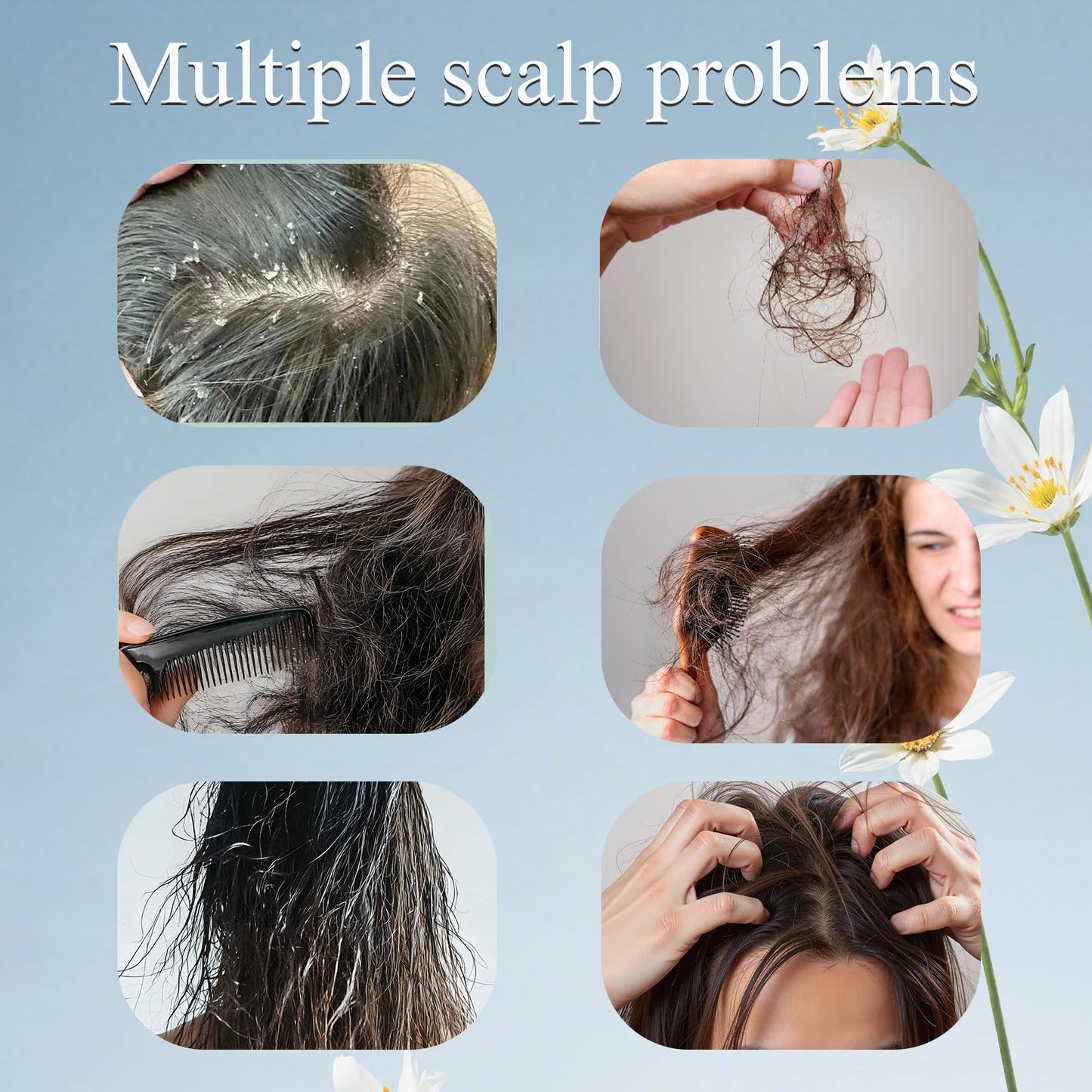 Trichology Shampoo | Anti-Hair Fall & Less Shedding & Volumizing Shampoo | Biotin, Arginine & Oleanolic Acid Strengthens Roots Promotes Hair Growth Oil Control & Scalp Nourishment 300ML (1PCS)