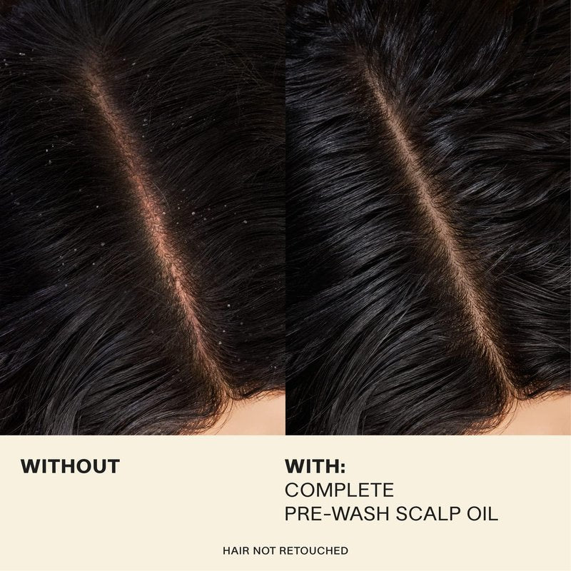 JVN Complete Pre-Wash Scalp Oil, 1.7 Fl Oz, Hair Treatment and Scalp Clarifying Oil Made with Rosemary Extract, Hair Care for Women and Men, Silicone Free