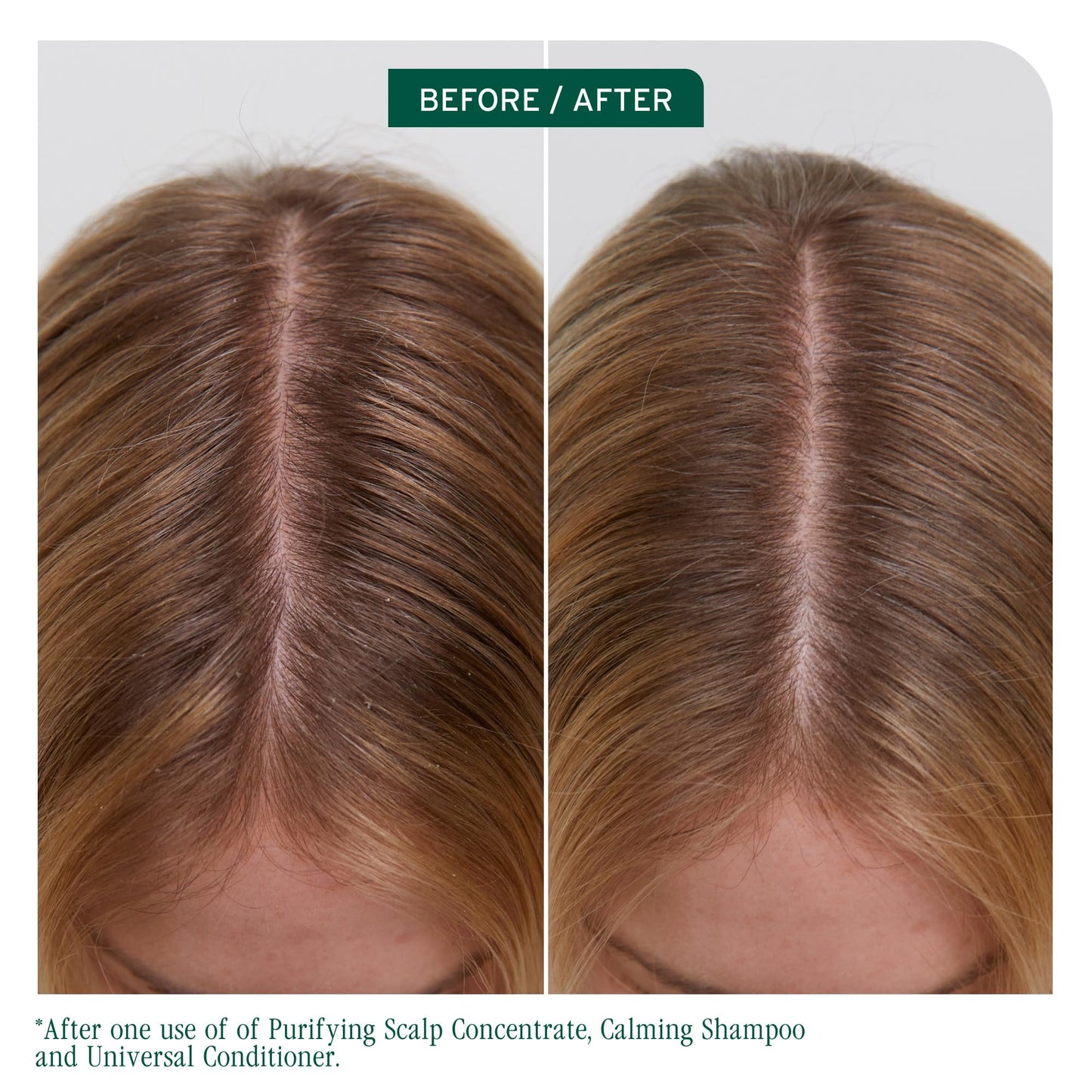Biolage Scalp Sync Calming Shampoo - Gently Cleanses Dry & Sensitive Scalps, Hydrates & Soothes, Fermented Tea Blend & Glycolic Acid, Vegan & Paraben-Free