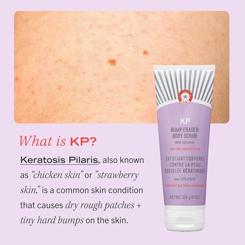 Jumbo Body KP Bump Eraser Duo - Exfoliating Scrub & Ingrown Hair Pads with 10% BHA/AHA | 10 oz Scrub, 60 Pads