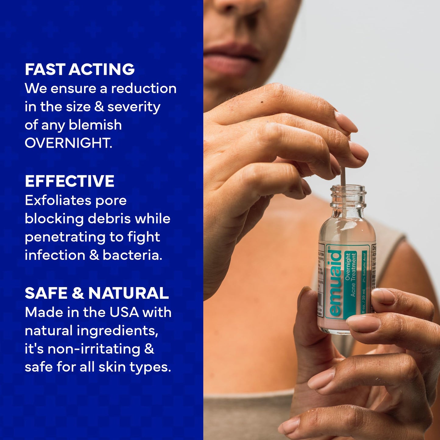 EMUAID Overnight Acne Treatment, Gentle Fast-Acting Solution with Salicylic Acid for Adults and Teens, Clears Stubborn Pimples, Cystic Acne, Blackheads, Rosacea, and Hormonal Breakouts, 1oz