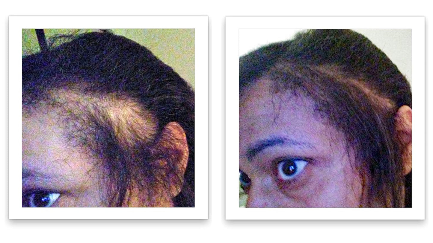 Caboki Hair Fibers - Natural Plant-Based Thinning Hair Solution for Men & Women | 10-Day Trial Size, Black
