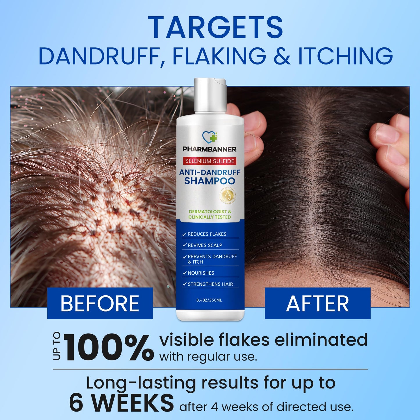 PHARMBANNER Anti-Dandruff Shampoo & Conditioner: Tea Tree Oil & Moroccan Argan Oil - Deep Hydration & Repair - Nourishes, Smooths, Restores Shine - Safe for Dry or Damaged Hair