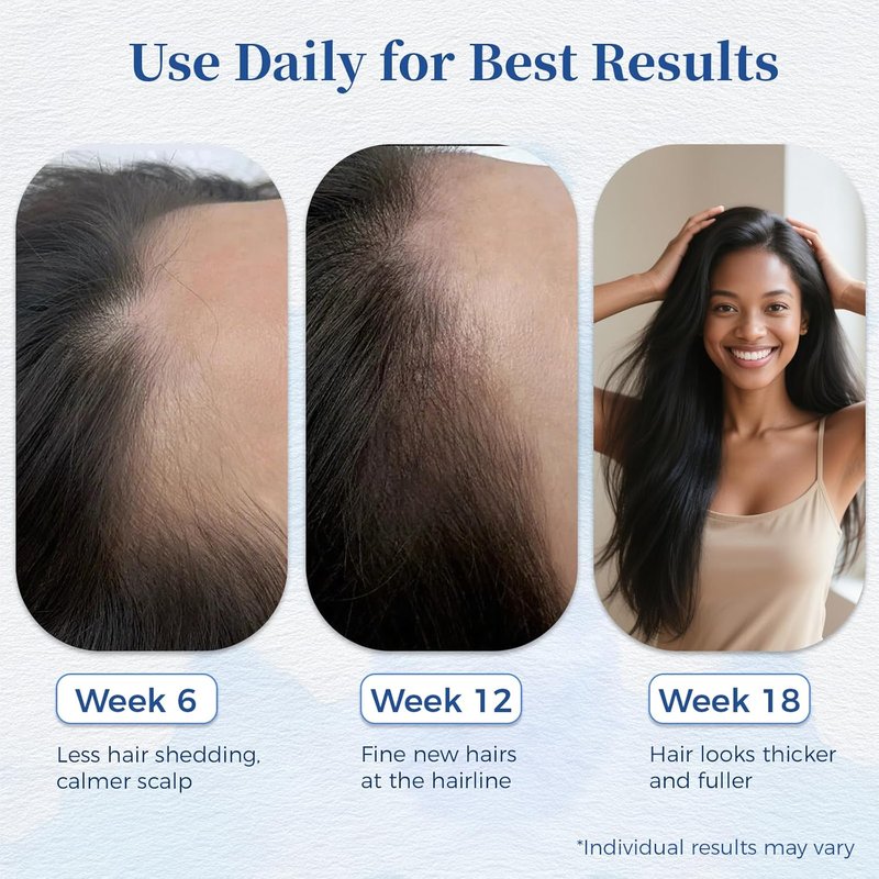Hair Growth Serum Roll-On - Rosemary & Saw Palmetto | Non-Greasy Formula for Thicker, Fuller Hair - 0.84 Fl Oz (Pack of 3)