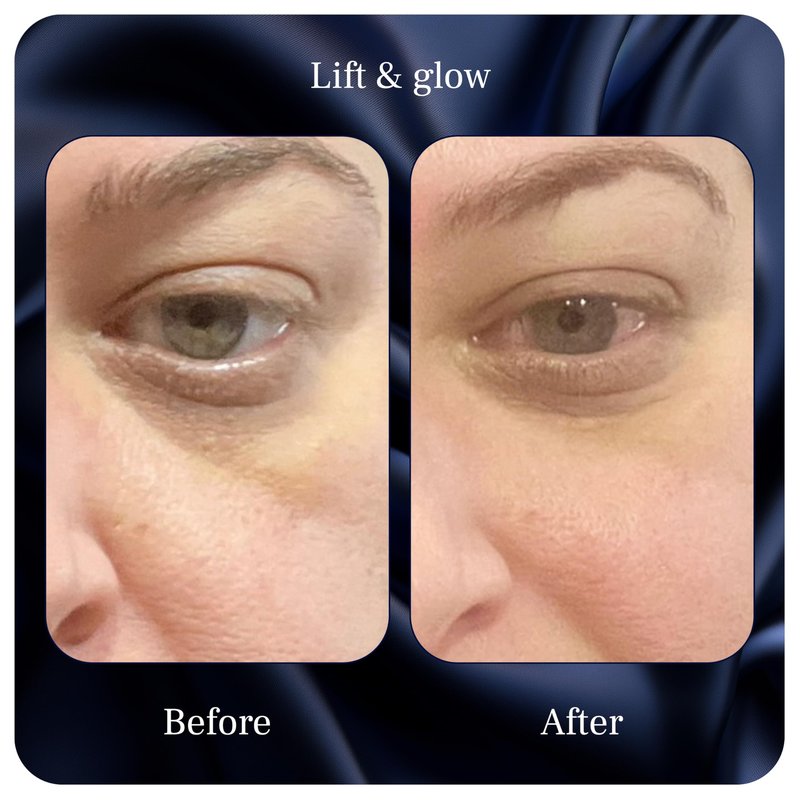 Lift & Glow Organic Eye Cream for Dark Circles and Puffiness - Anti Aging Eye Cream for Wrinkles - Reduces Dark Circles and Under Eye Bags - With Kakadu Plum, Coconut Oil, Spirulina & More - 1 Fl Oz