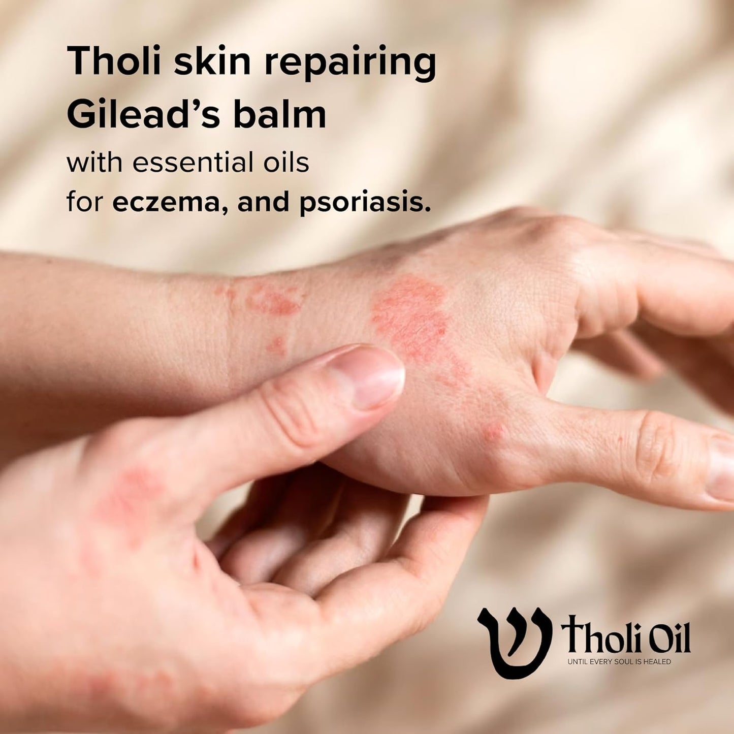 Balm of Gilead Skin Repair Salve - Fast-Acting Natural Formula for Dry, Damaged Skin | With Poplar Buds & Cocoa Butter