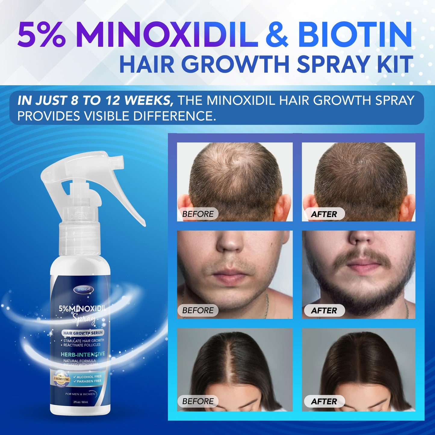5% Minoxidil Hair Growth for Men and Women: Extra Strength Minoxidil and Biotin Beard Regrowth (2 Fl Oz, Spray 3pcs)