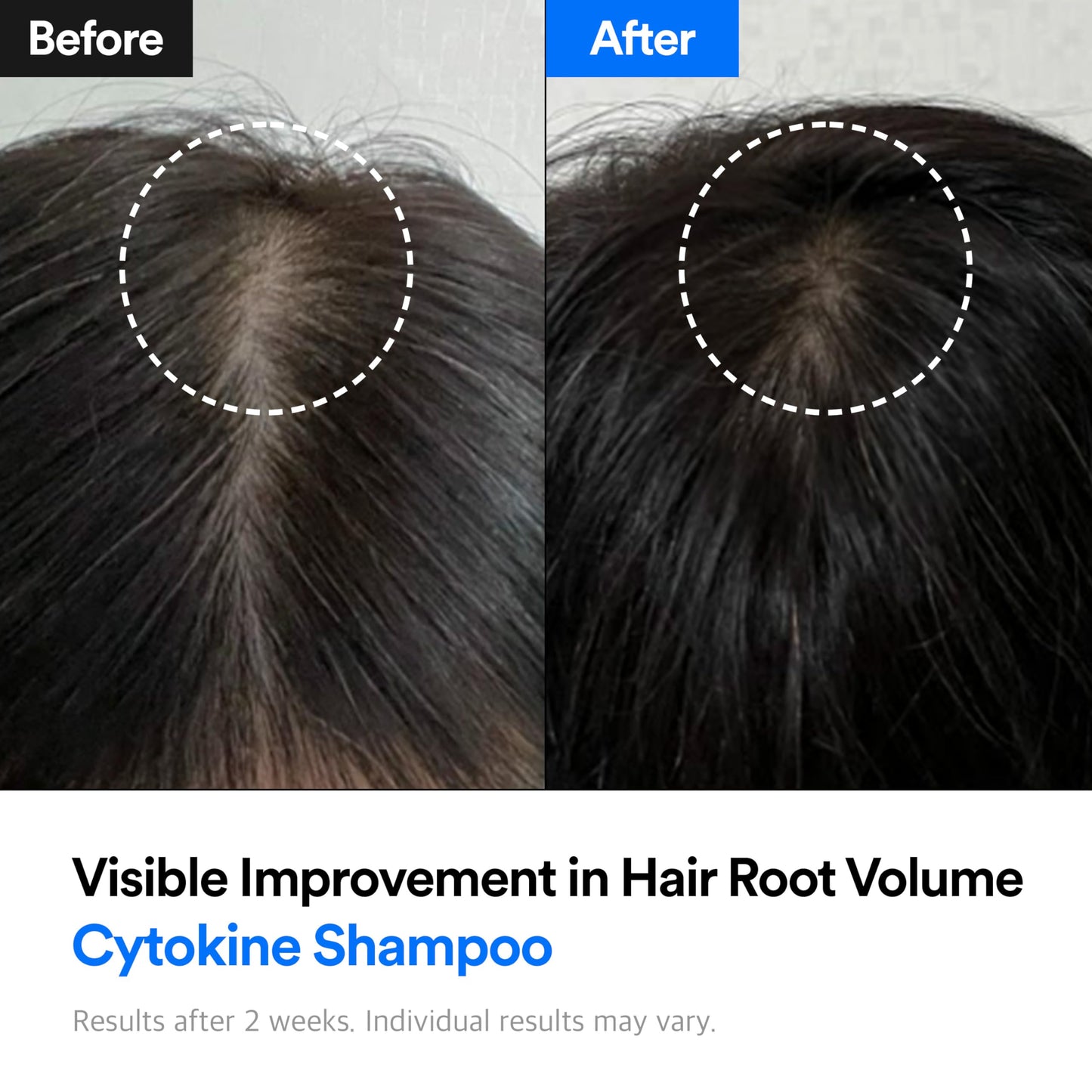 Refilled Hair-Recovery Cytokine Shampoo Plus Moisture Care,12.8 Fl. Oz. – Hair Thickening Shampoo for Thinning Hair, Anti-Hair Loss, Hydrating, Strengthening and Volumizing, Sulfate-Free Formula