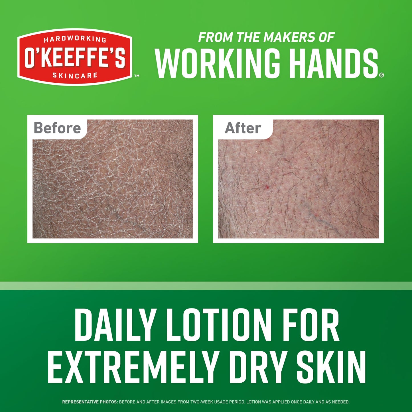 O’Keeffe’s Hardworking Body Lotion, Deep Hydration for Extremely Dry & Cracked Skin, 12 oz Pump (2 Pack), Fragrance-Free & Hypoallergenic, Non-Greasy Fast-Absorbing Formula