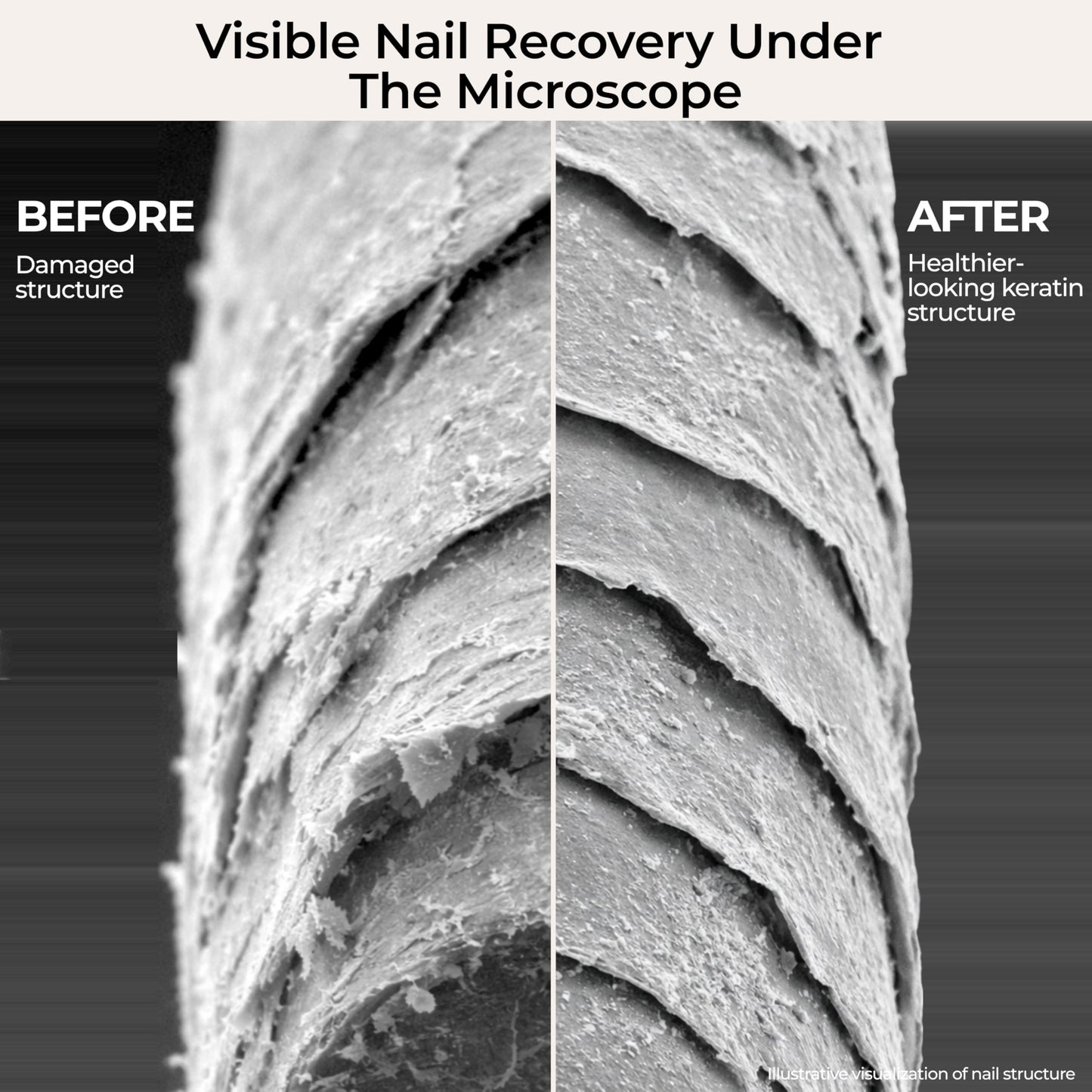 Fast Absorbing Nail Strengthening Serum for Damaged, Brittle & Thin Nails — Post-Acrylic & Gel Damage Treatment with Keratin, Peptides, Hyaluronic Acid & Niacinamide — 45-Day Supply by nakeyNails