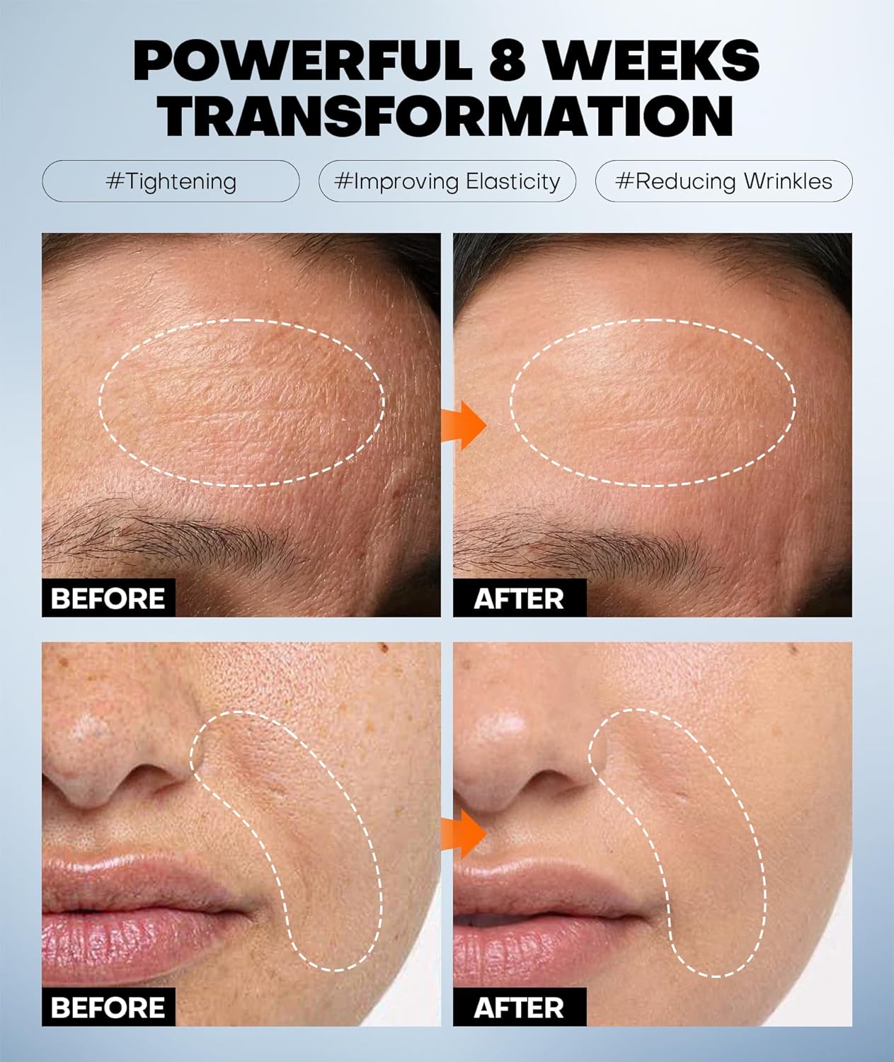Radiant Glow Collagen Face Mask - Deep Hydrating Overnight Skincare with Hyaluronic Acid & Vitamin E | 34g x 5ea