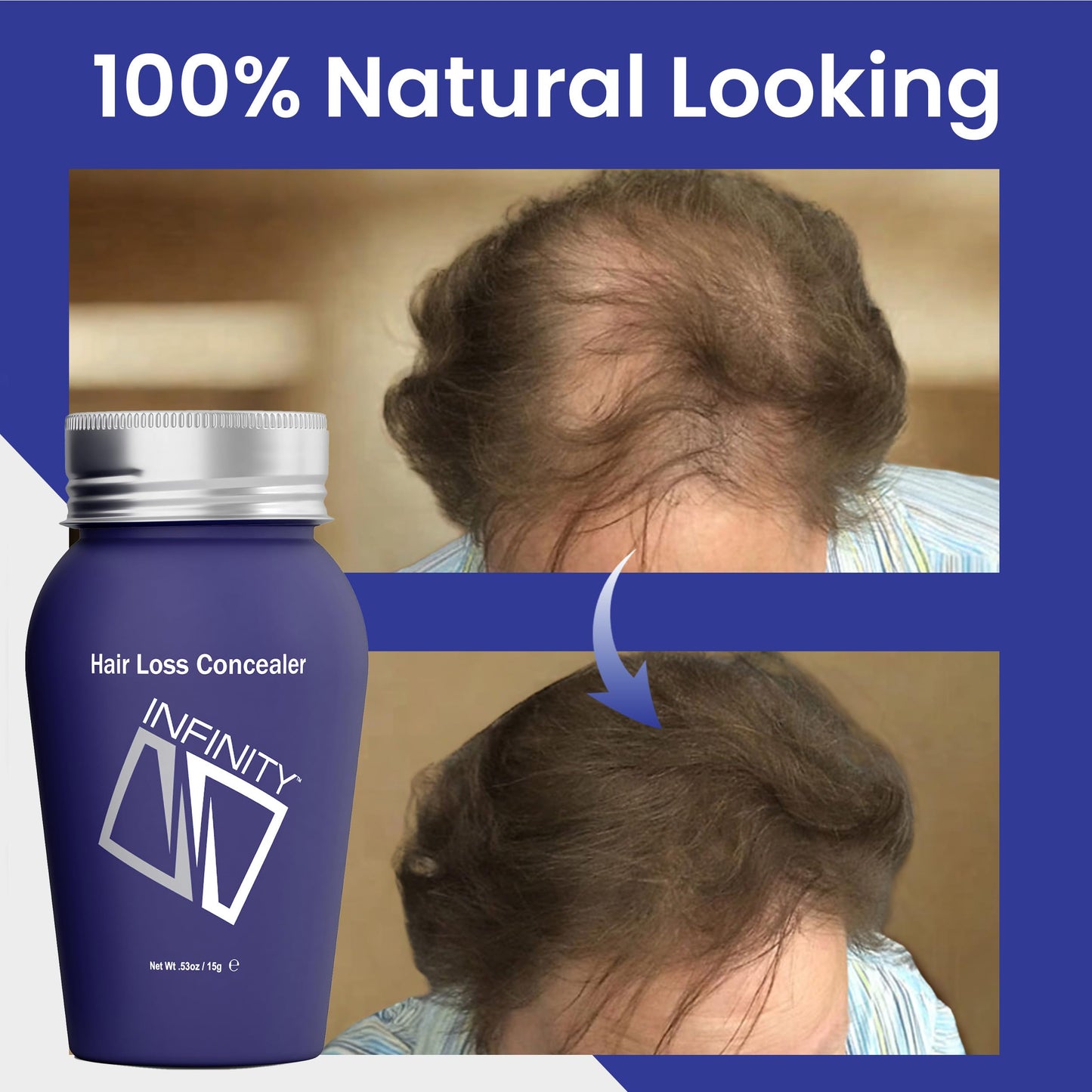 INFINITY Hair Fibers Dark Brown for Thinning Hair for Women & Men - 100% Undetectable Hair Building Fiber Powder - Conceal Hair Loss in 15 Seconds, 30g