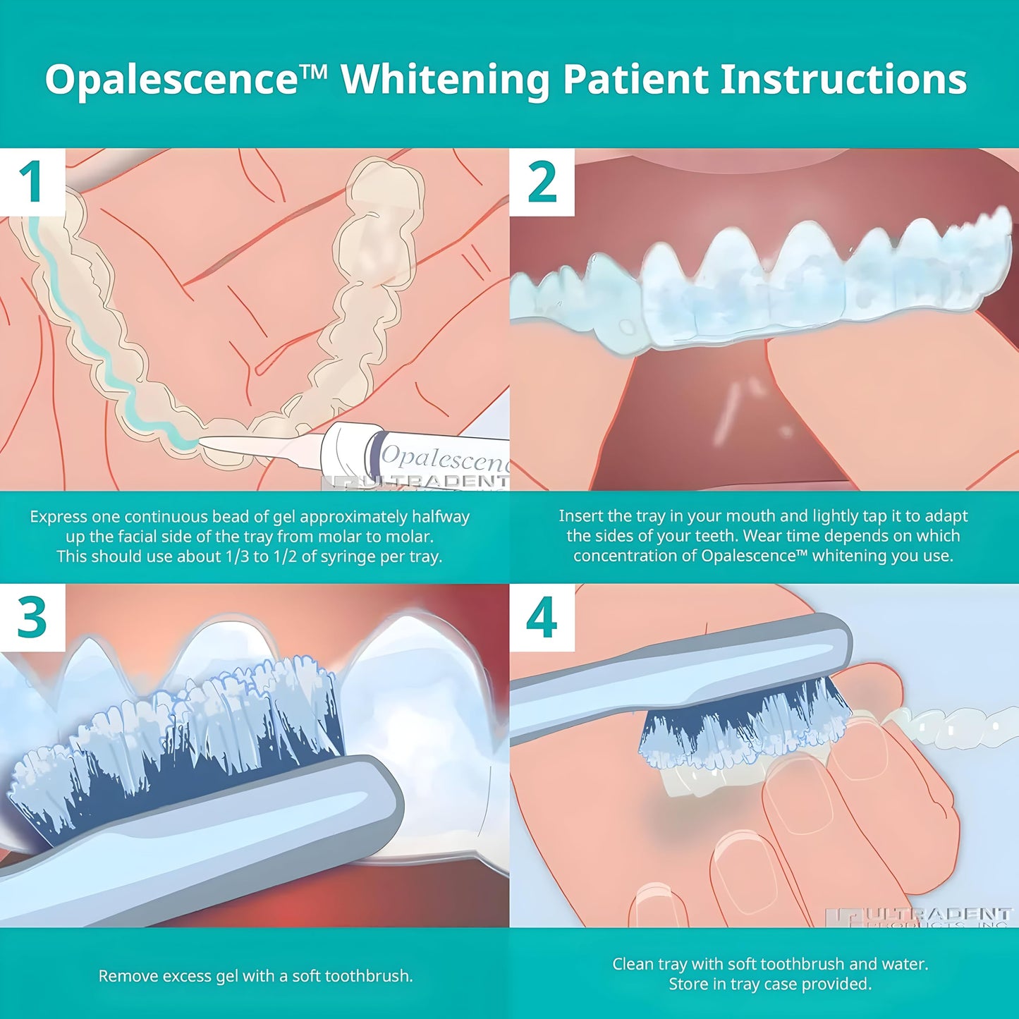 Opalescence 15% Gel Syringes Teeth Whitening Refill Kit - Low Sensitivity (4 Syringes) - Cool Mint - Carbamide Peroxide - Made in The USA by Ultradent Tooth Whitening - 5195-2