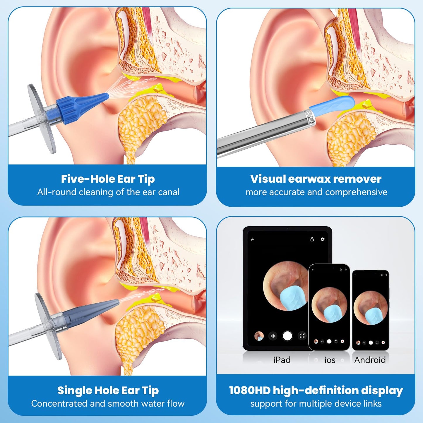 Ear Wax Removal - Ear Cleaner - Ear Camera - FSA HSA Eligible - Ear Wax Removal Kit - Ear Wax Removal Tool Camera - 1080HD Effective for Cleaning Ear Wax Build-Up