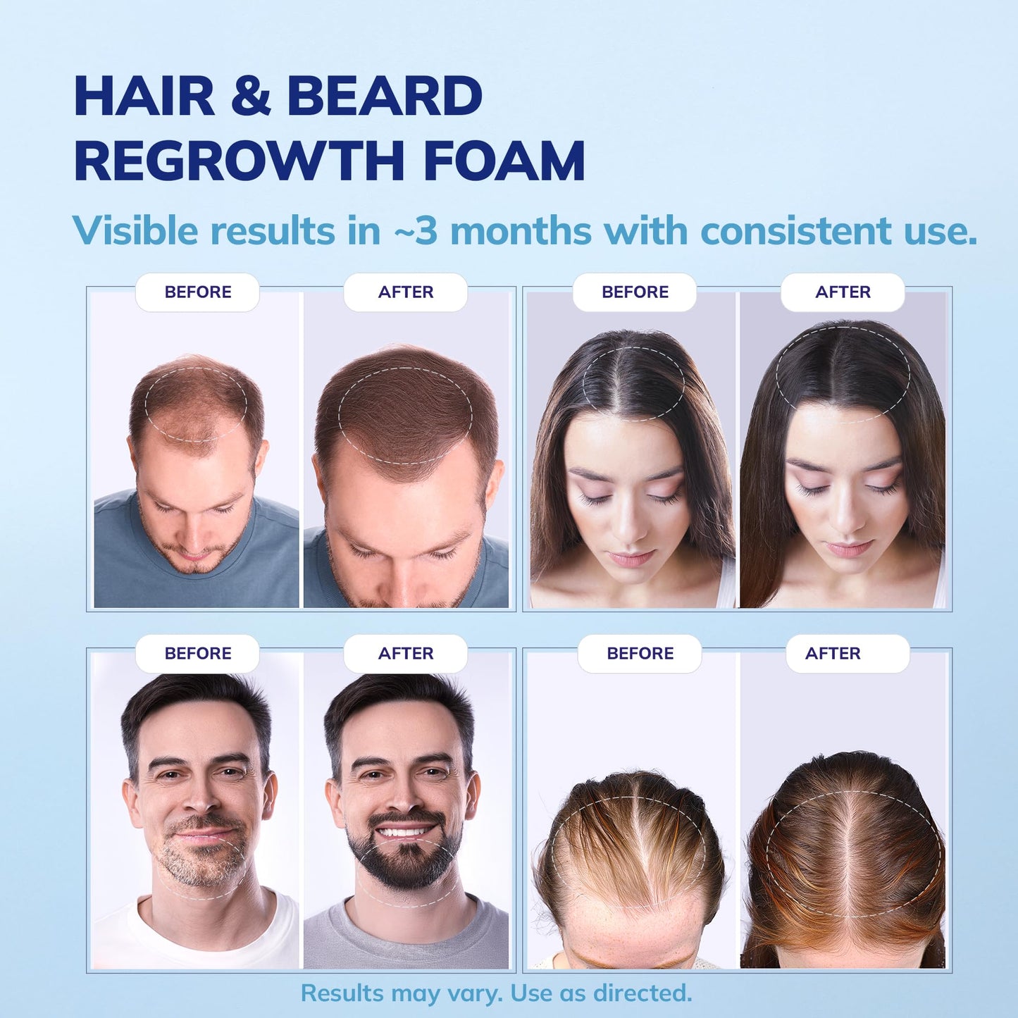 Foam for men and women, Hair Health Solution 6 FL OZ