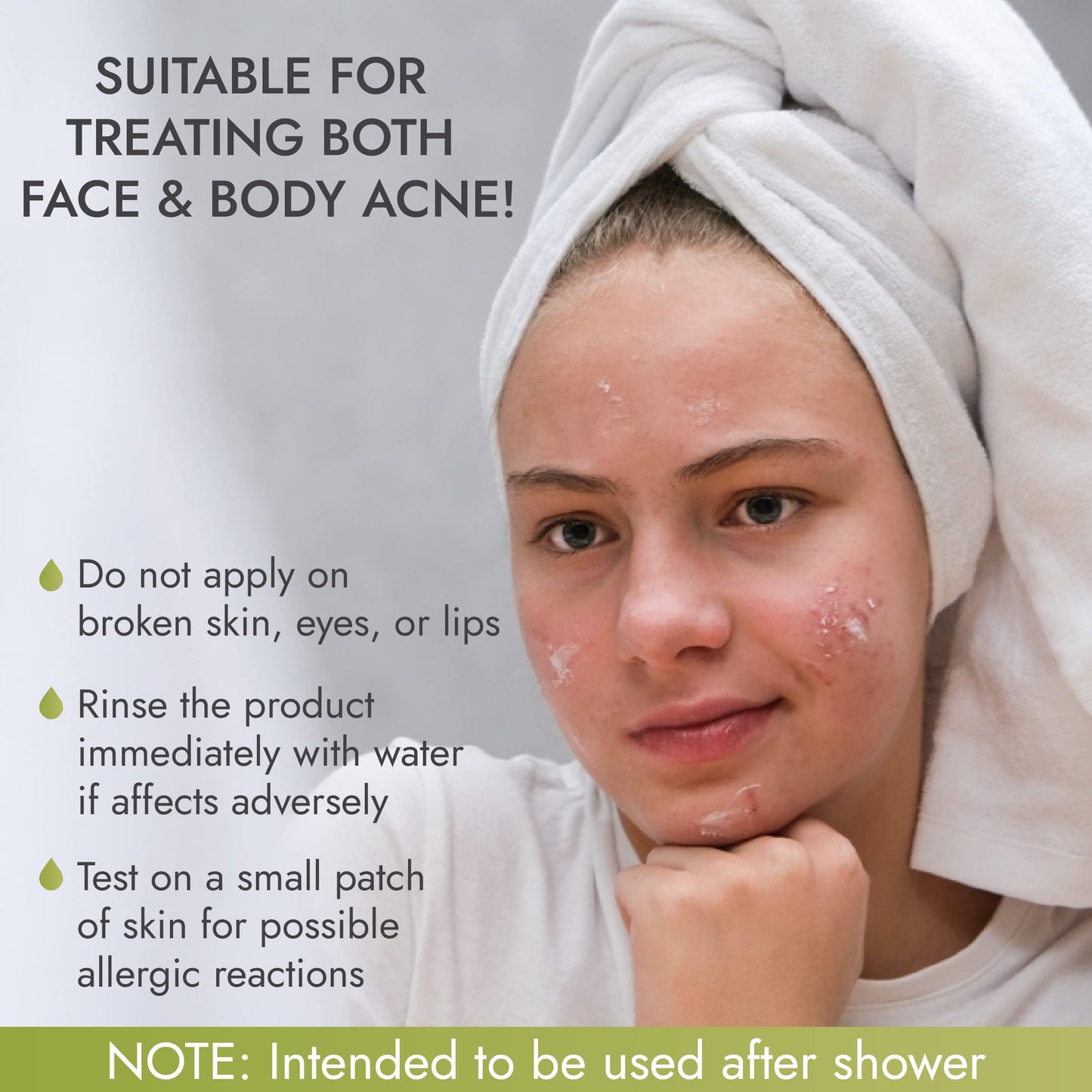 Rena Levi Acne Spot Pimple Drying Lotion - For Face and Body Use, Dries Out Blemishes and Pores - 1oz