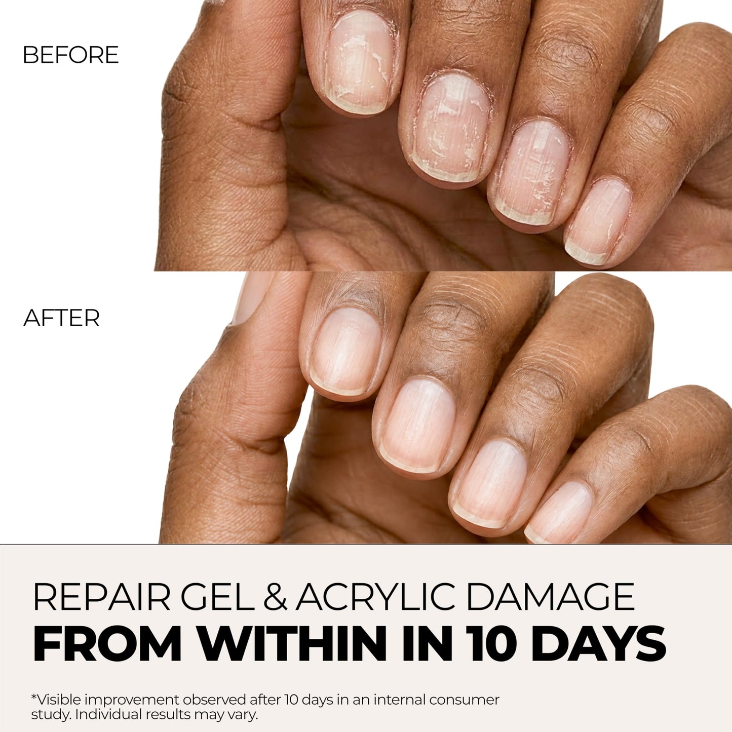 Fast Absorbing Nail Strengthening Serum for Damaged, Brittle & Thin Nails — Post-Acrylic & Gel Damage Treatment with Keratin, Peptides, Hyaluronic Acid & Niacinamide — 45-Day Supply by nakeyNails