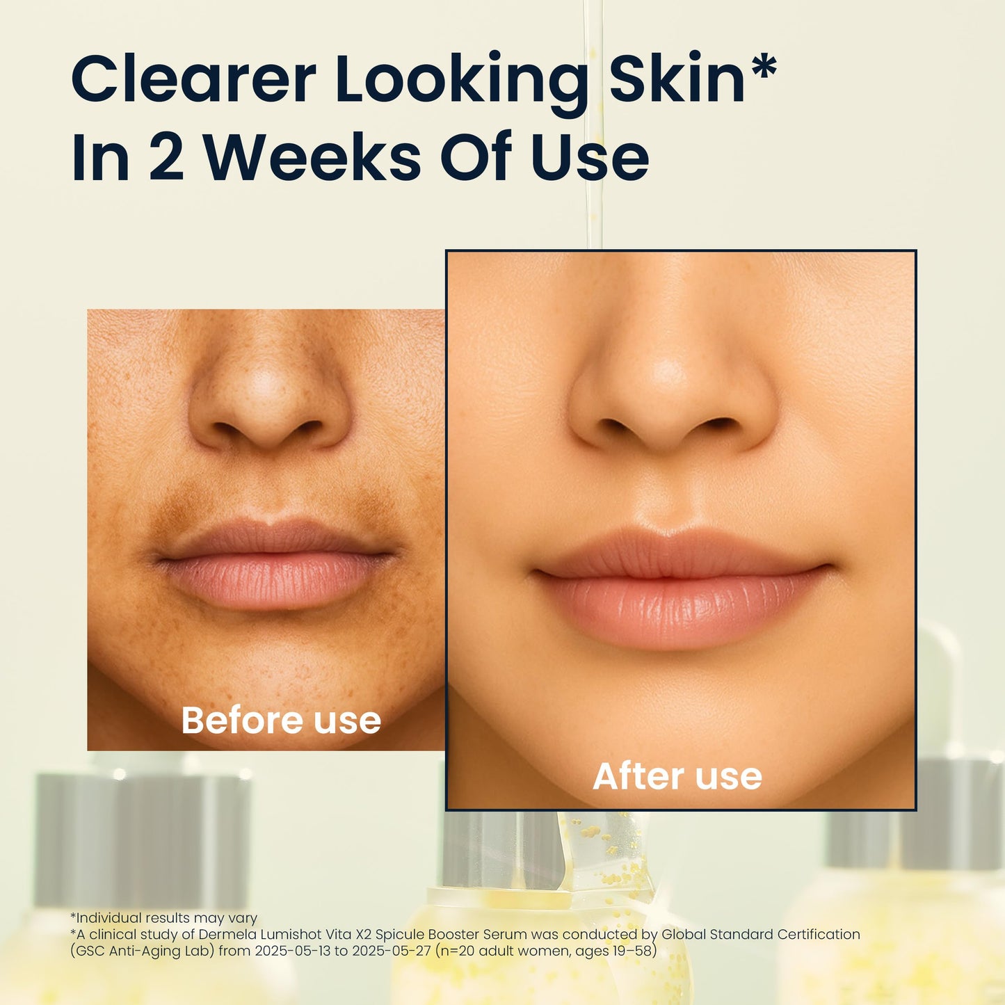 Dermela Lumishot Vita X2 Spicule Booster Serum, Vegan Spicules with Vitamin C + Niacinamide, Glutathione & Panthenol, Brightening & Texture Care 1.01 fl oz (30ml) | Korean Face Serum for Uneven Tone